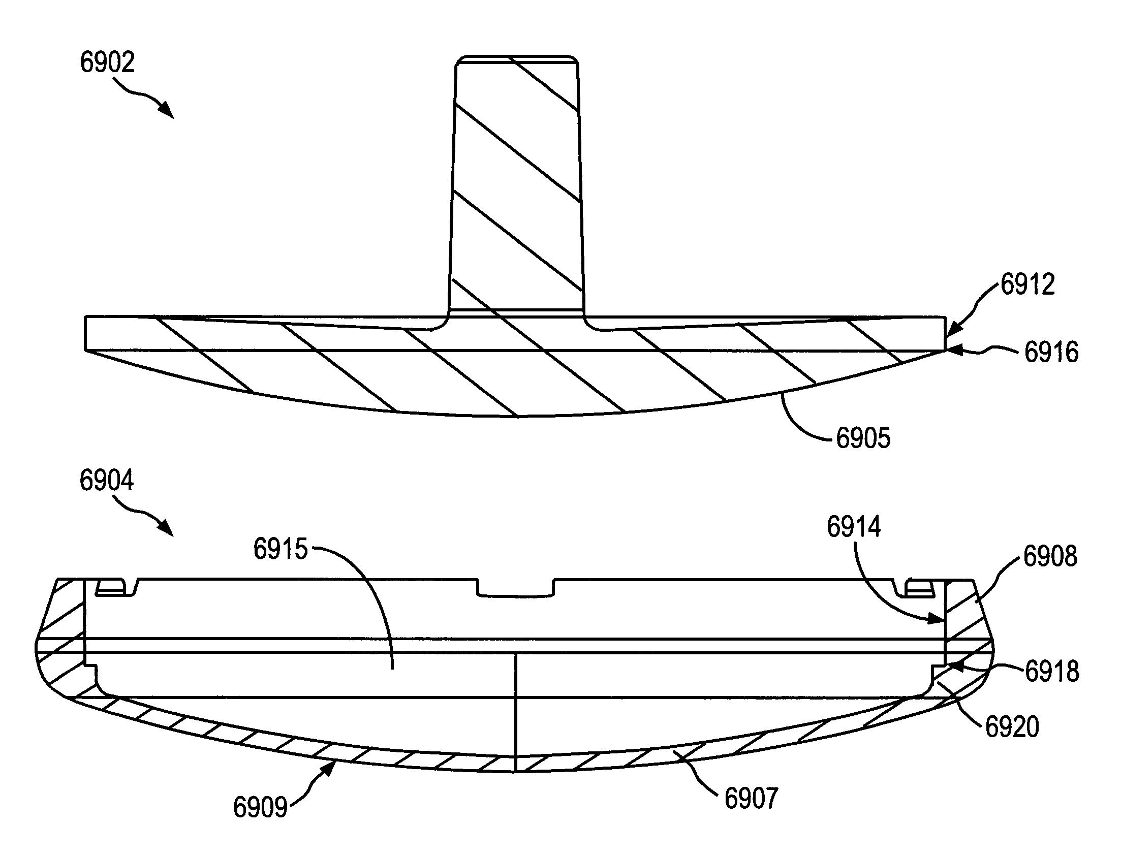 System and method for joint resurface repair