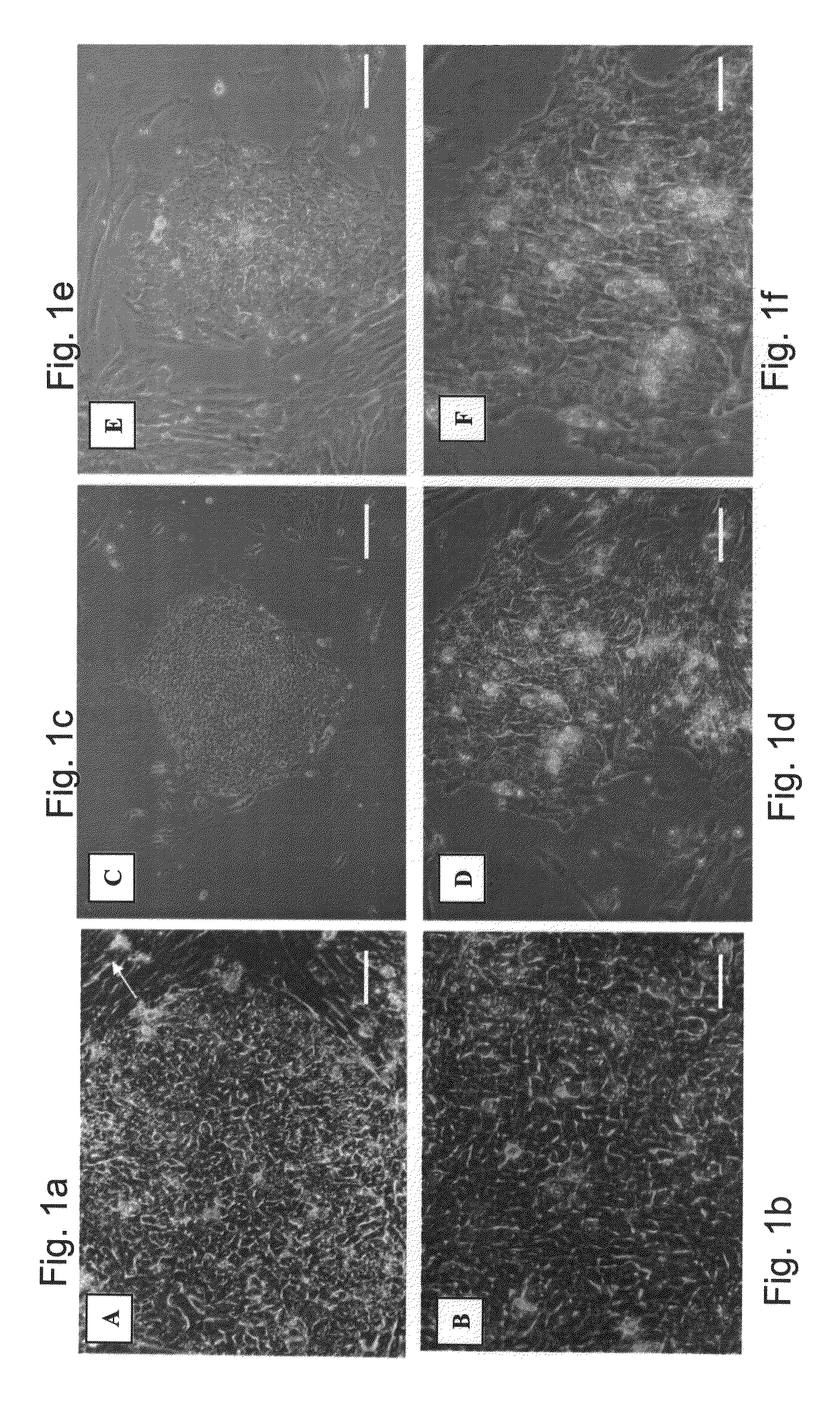 Media for culturing stem cells