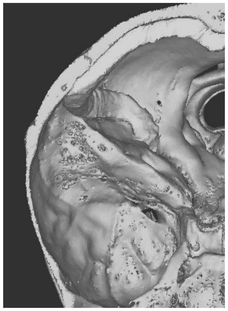 A bone-like 3D printing material and a bone-like 3D printed temporal bone model with bone-like structure and neurovascular structure