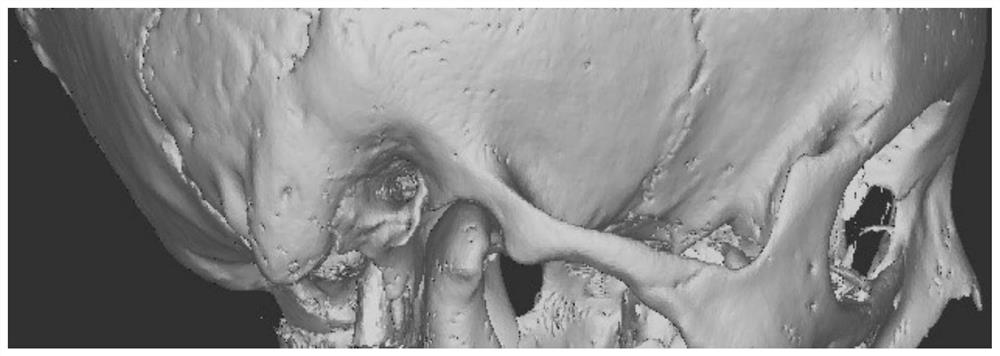 A bone-like 3D printing material and a bone-like 3D printed temporal bone model with bone-like structure and neurovascular structure