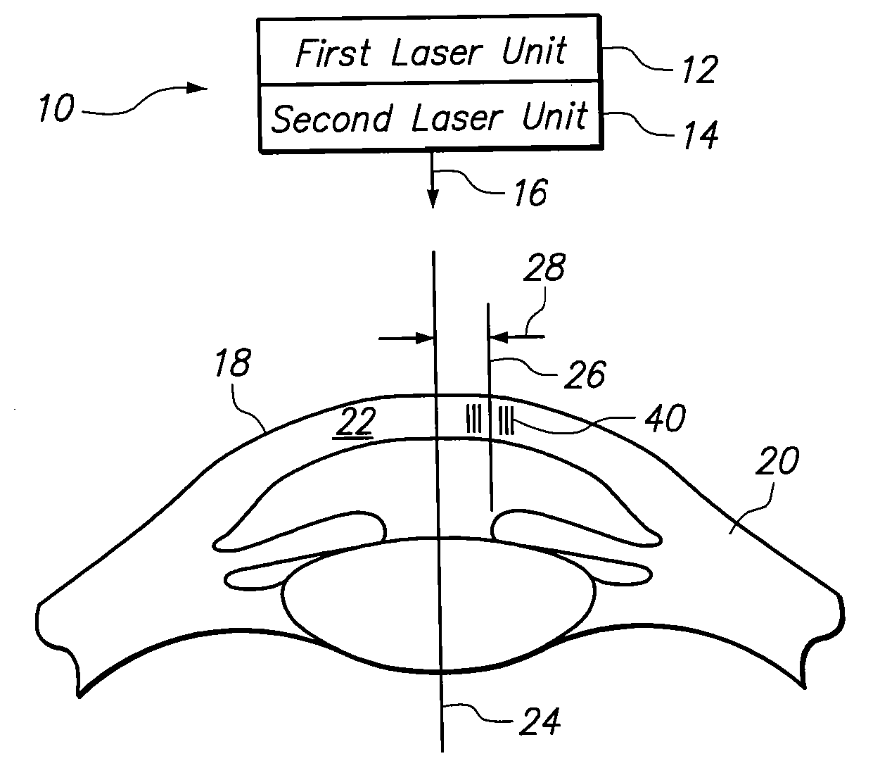 System and Methods for Minimizing Higher Order Aberrations Introduced During Refractive Surgery