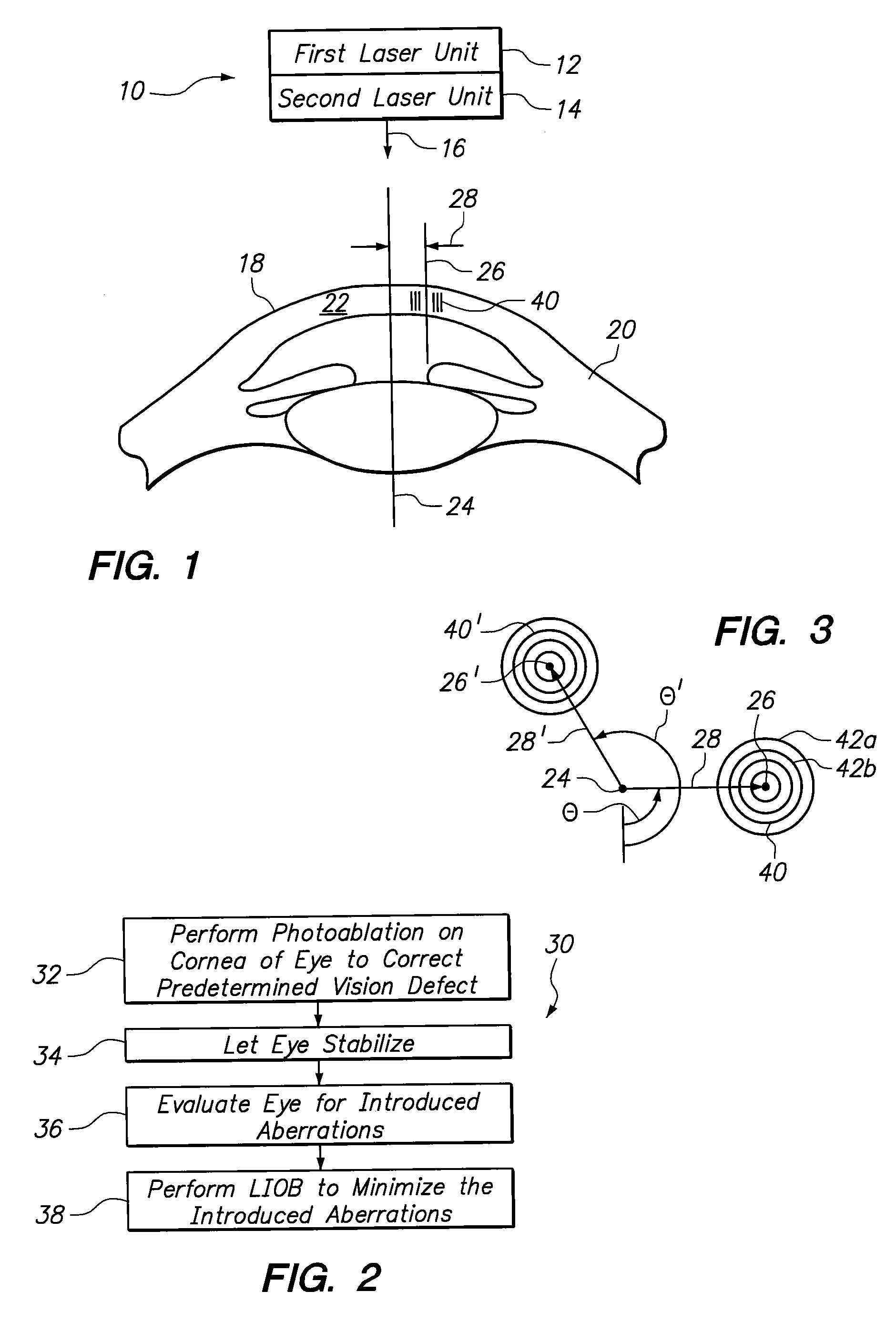 System and Methods for Minimizing Higher Order Aberrations Introduced During Refractive Surgery