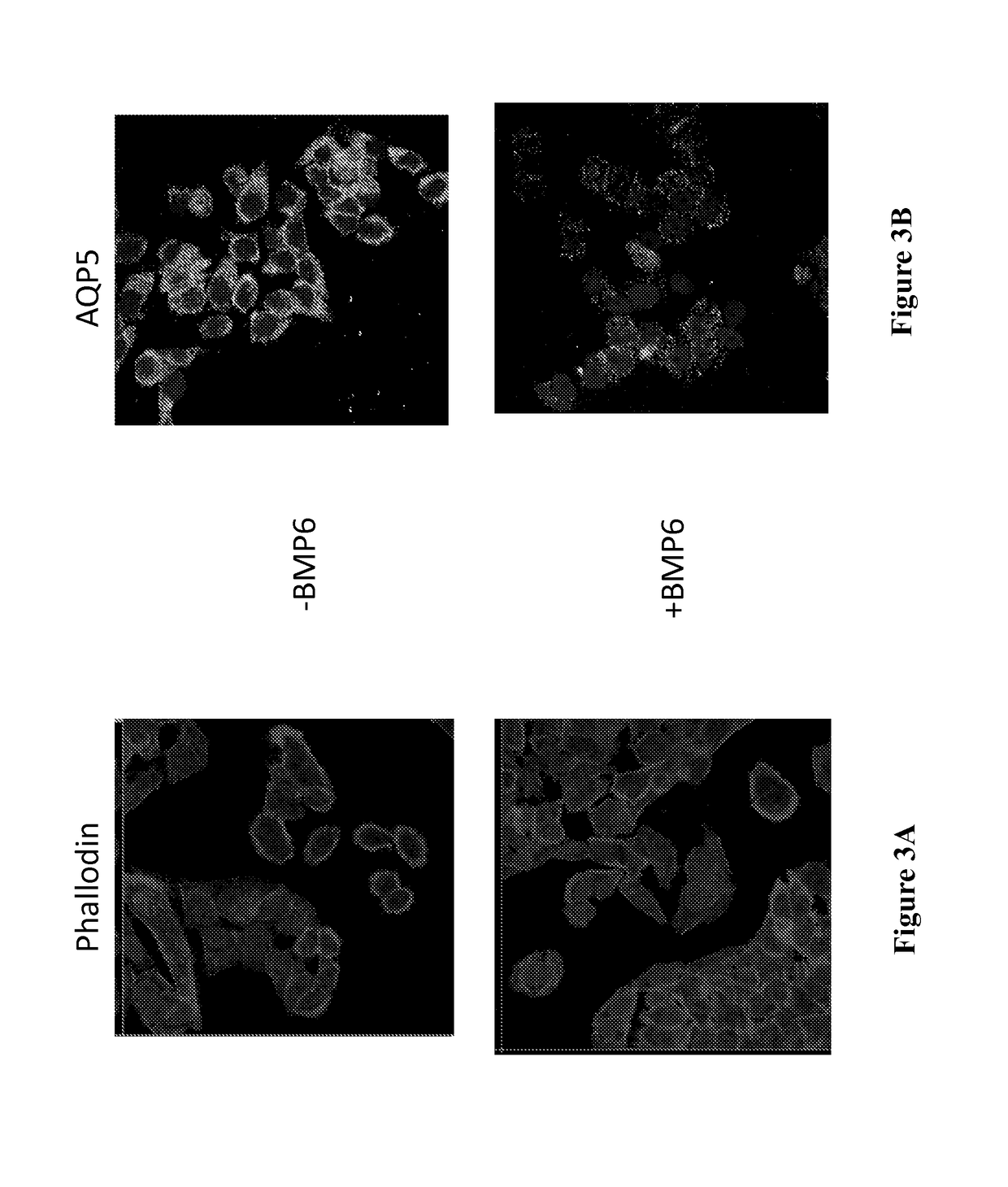 AAV mediated aquaporin gene transfer to treat Sjogren's syndrome