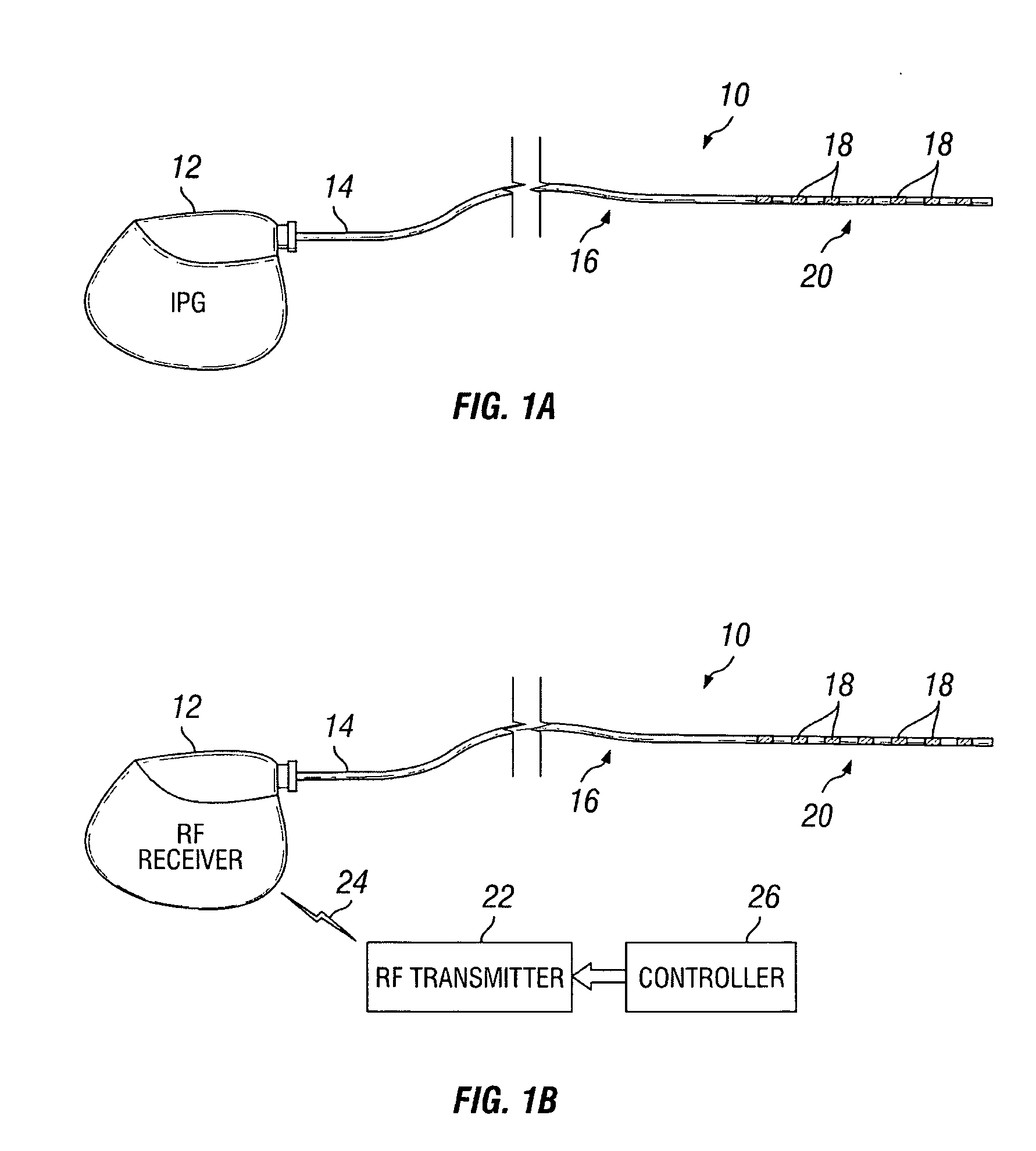 Method of using spinal cord stimulation to treat gastrointestinal and/or eating disorders or conditions