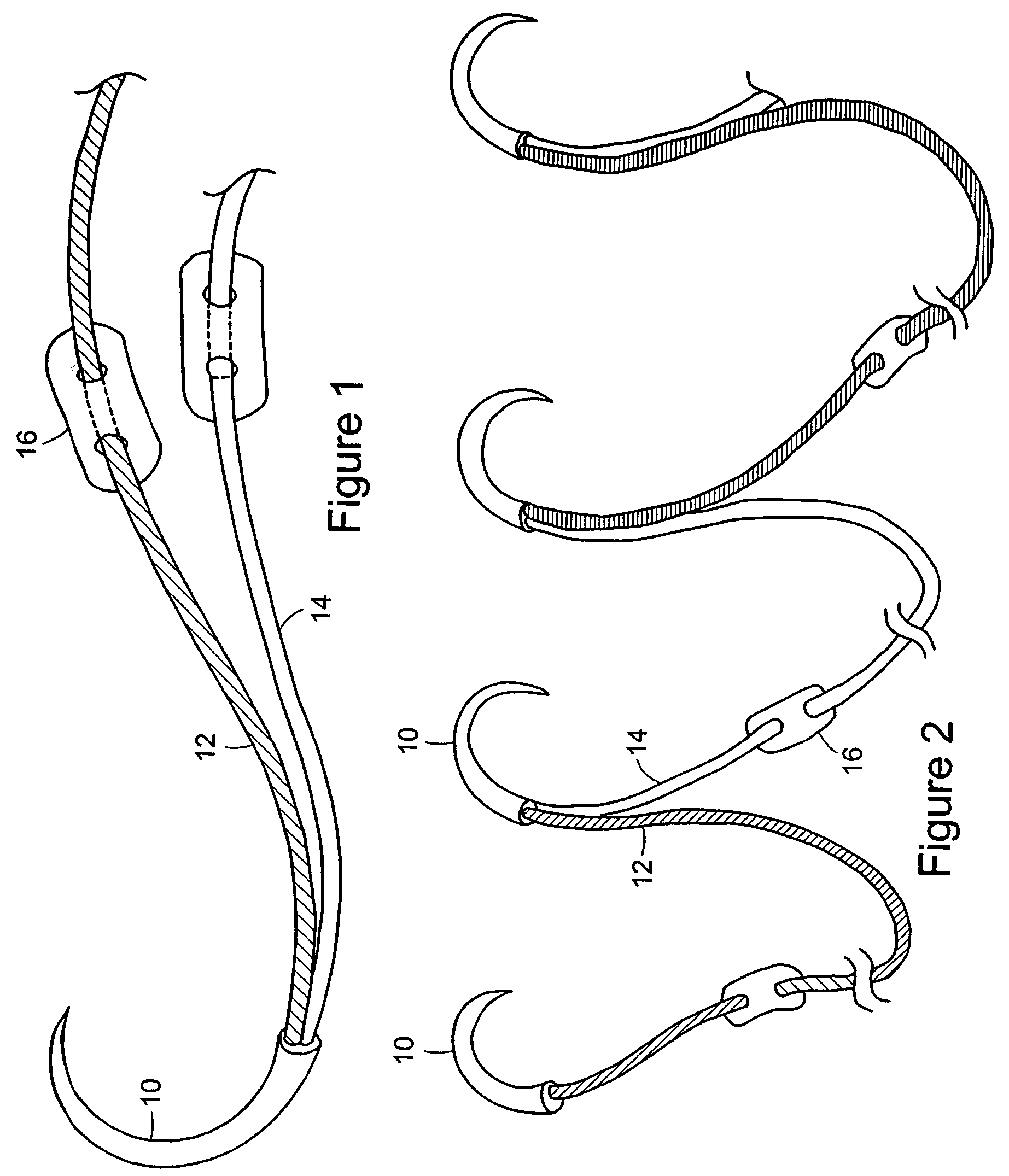 Suture system