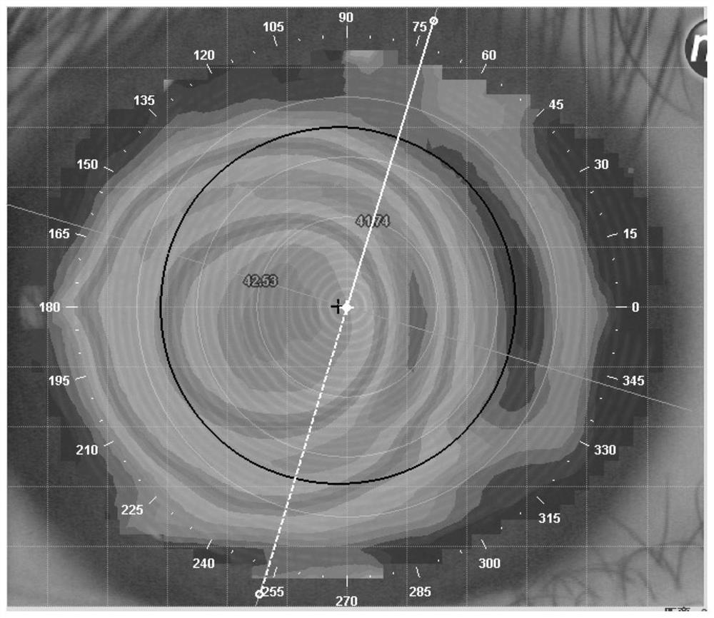 Data processing method based on orthokeratology lens fitting and related equipment