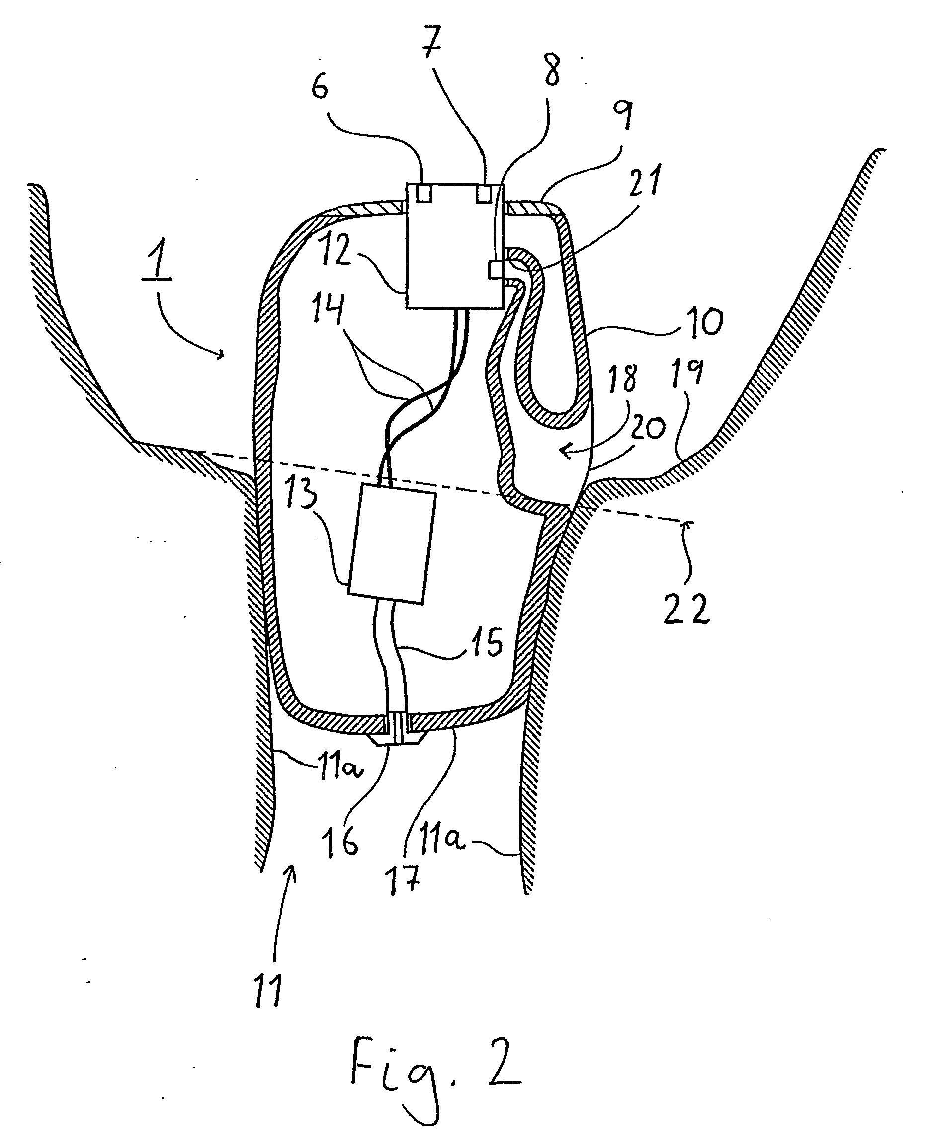 Hearing aid and a method of processing a sound signal in a hearing aid