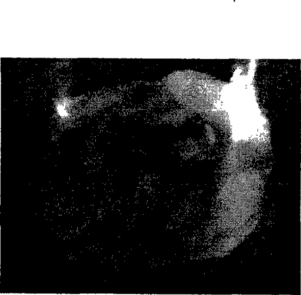 Method for converting island cotton by agrobacterium-mediated transformation