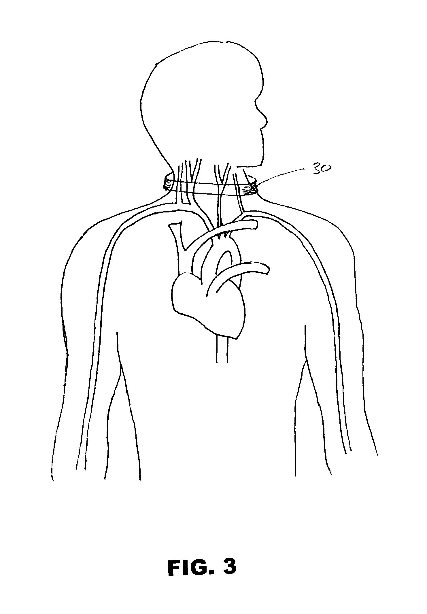 Regulation of cerebral blood flow by temperature change-induced vasodilatation