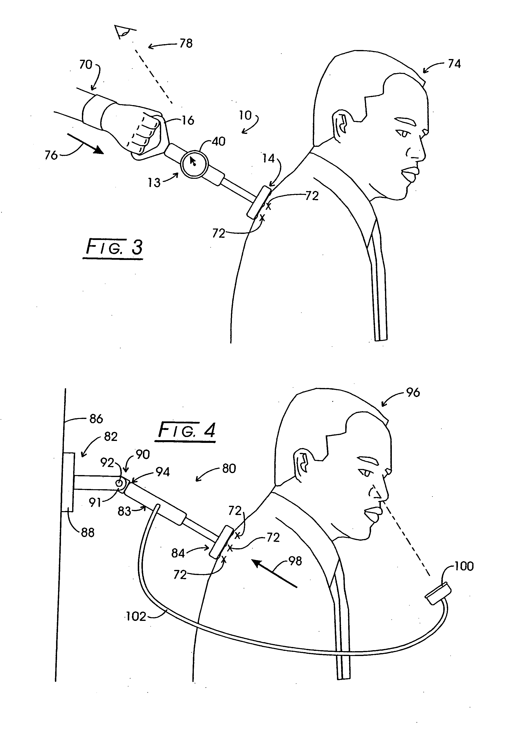 Apparatus, systems, and methods for continuous pressure technique therapy