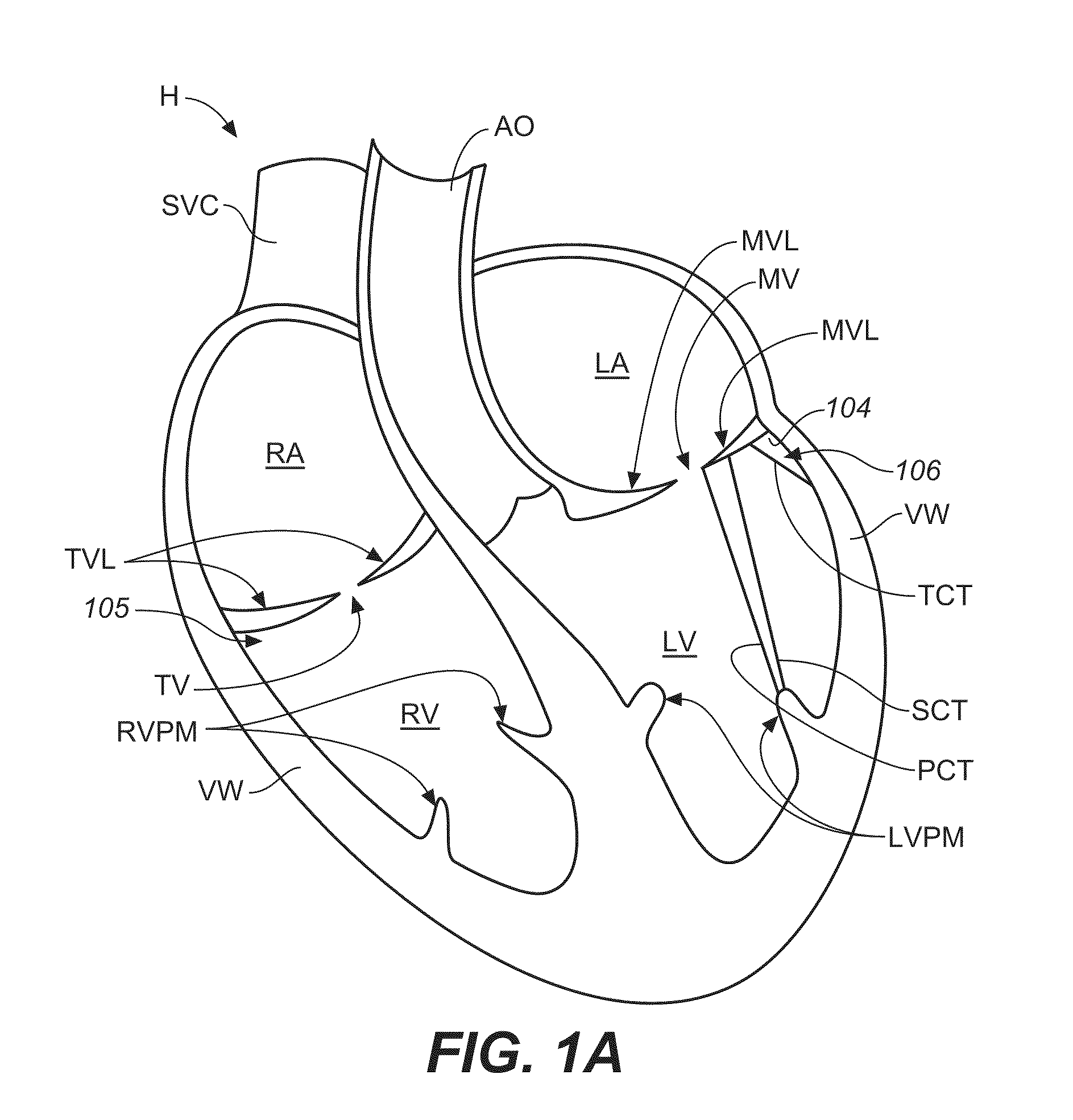 Diagnostic catheters, guide catheters, visualization devices and chord manipulation devices, and related kits and methods