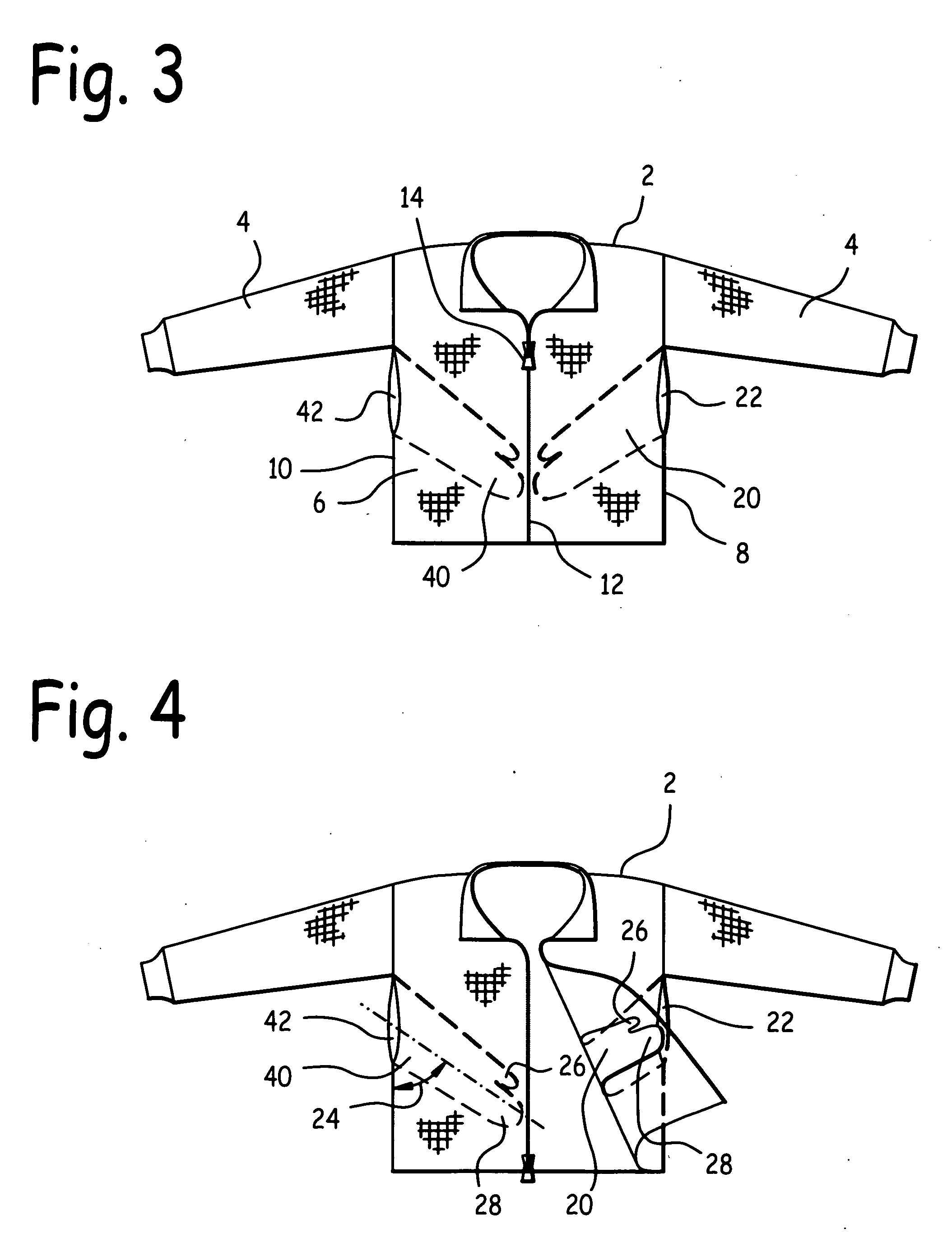 Garment with underarm externally accessible breast pockets and method of use