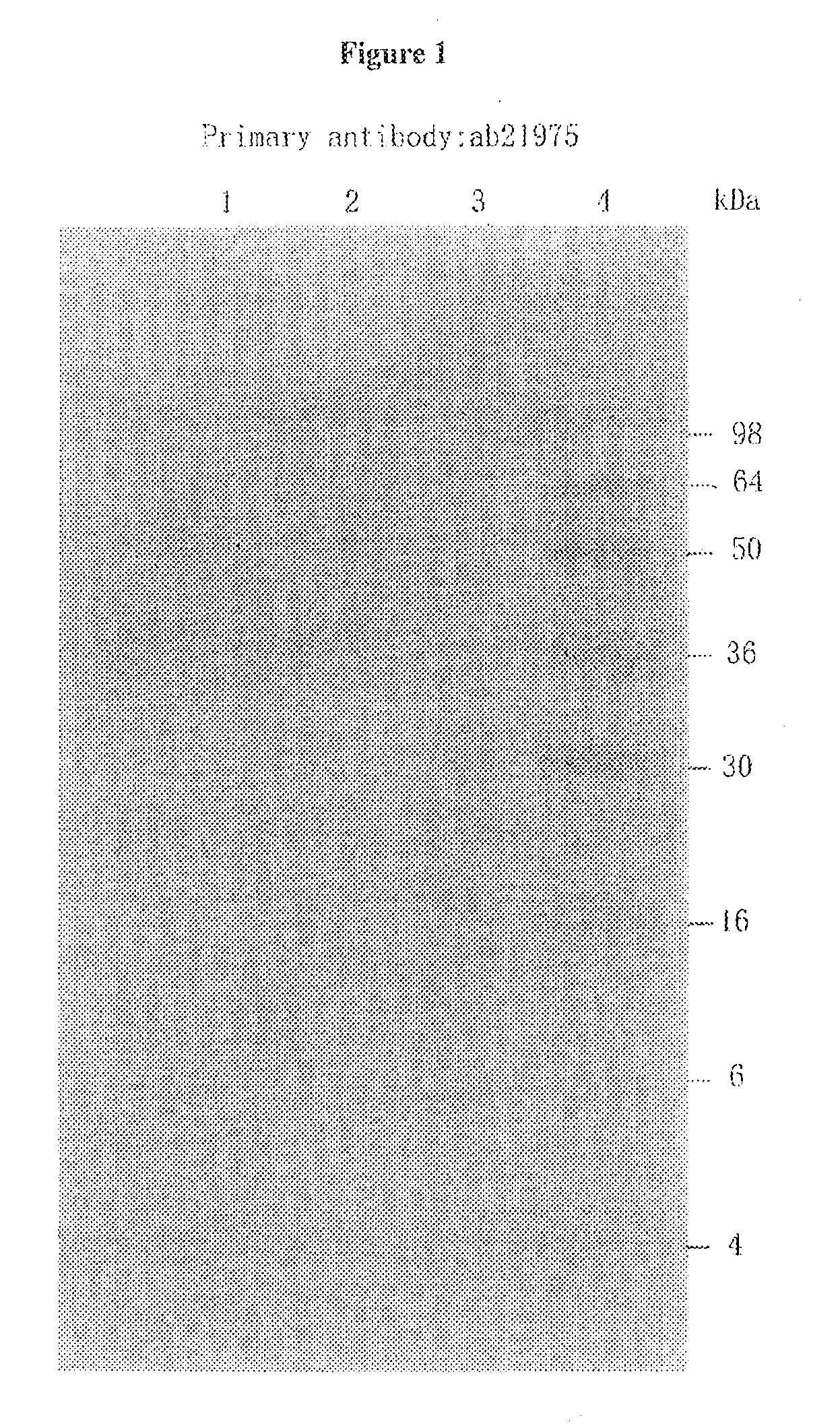 Tissue kallikrein for the treatment of parkinson's disease