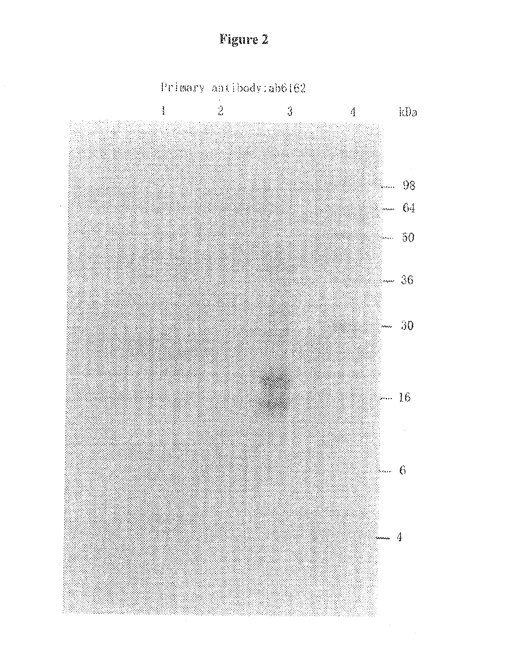 Tissue kallikrein for the treatment of parkinson's disease