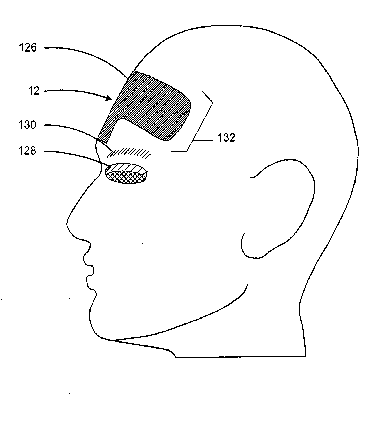 Method and system for treating muscle, tendon, ligament and cartilage tissue