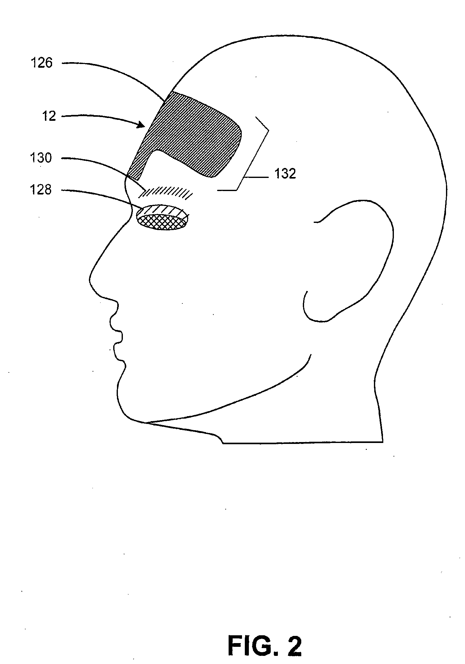 Method and system for treating muscle, tendon, ligament and cartilage tissue