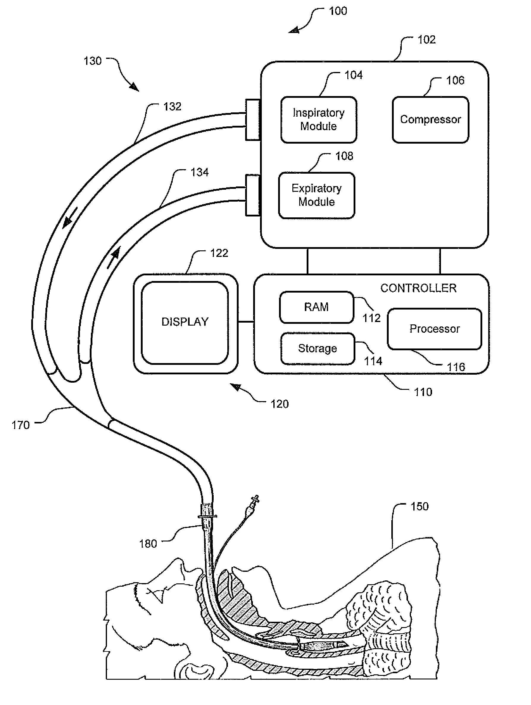 Event-Based Delay Detection And Control Of Networked Systems In Medical Ventilation