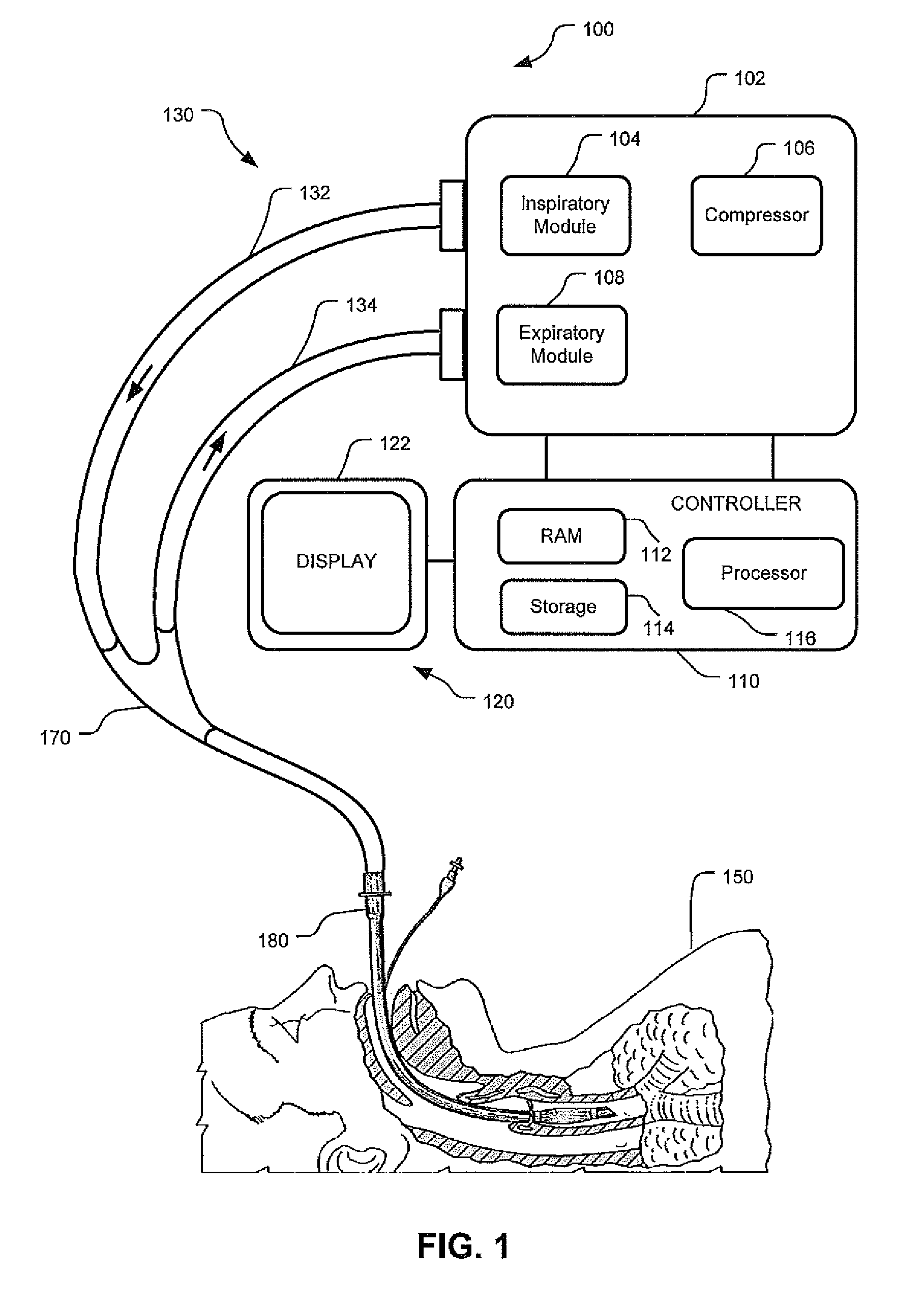 Event-Based Delay Detection And Control Of Networked Systems In Medical Ventilation