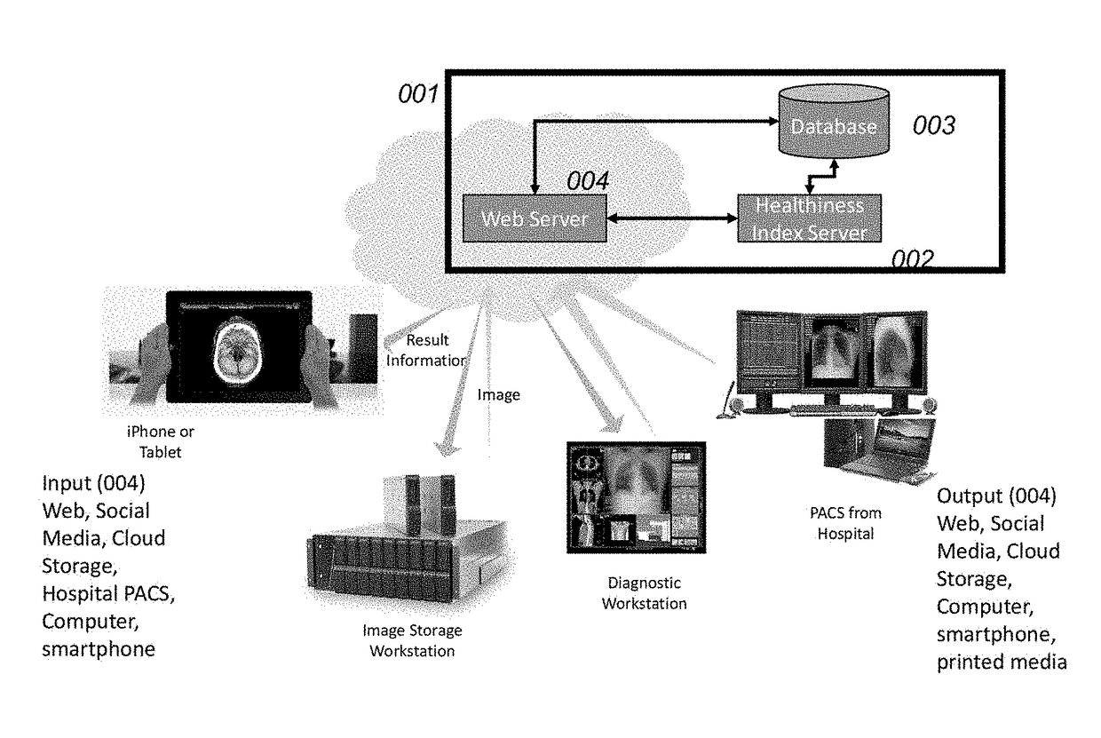 System and method for the classification of healthiness index from chest radiographs of a healthy person