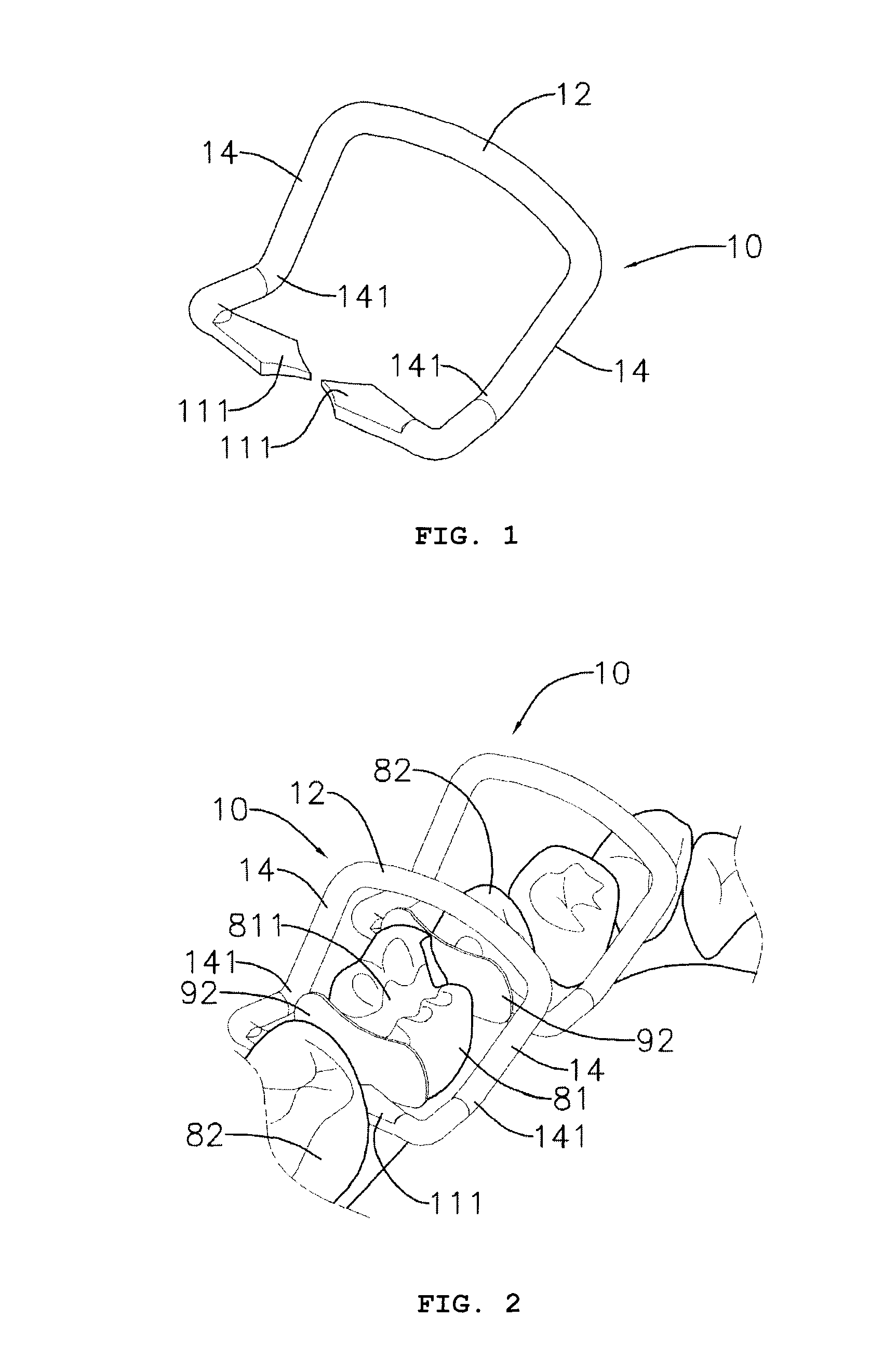 Separating ring