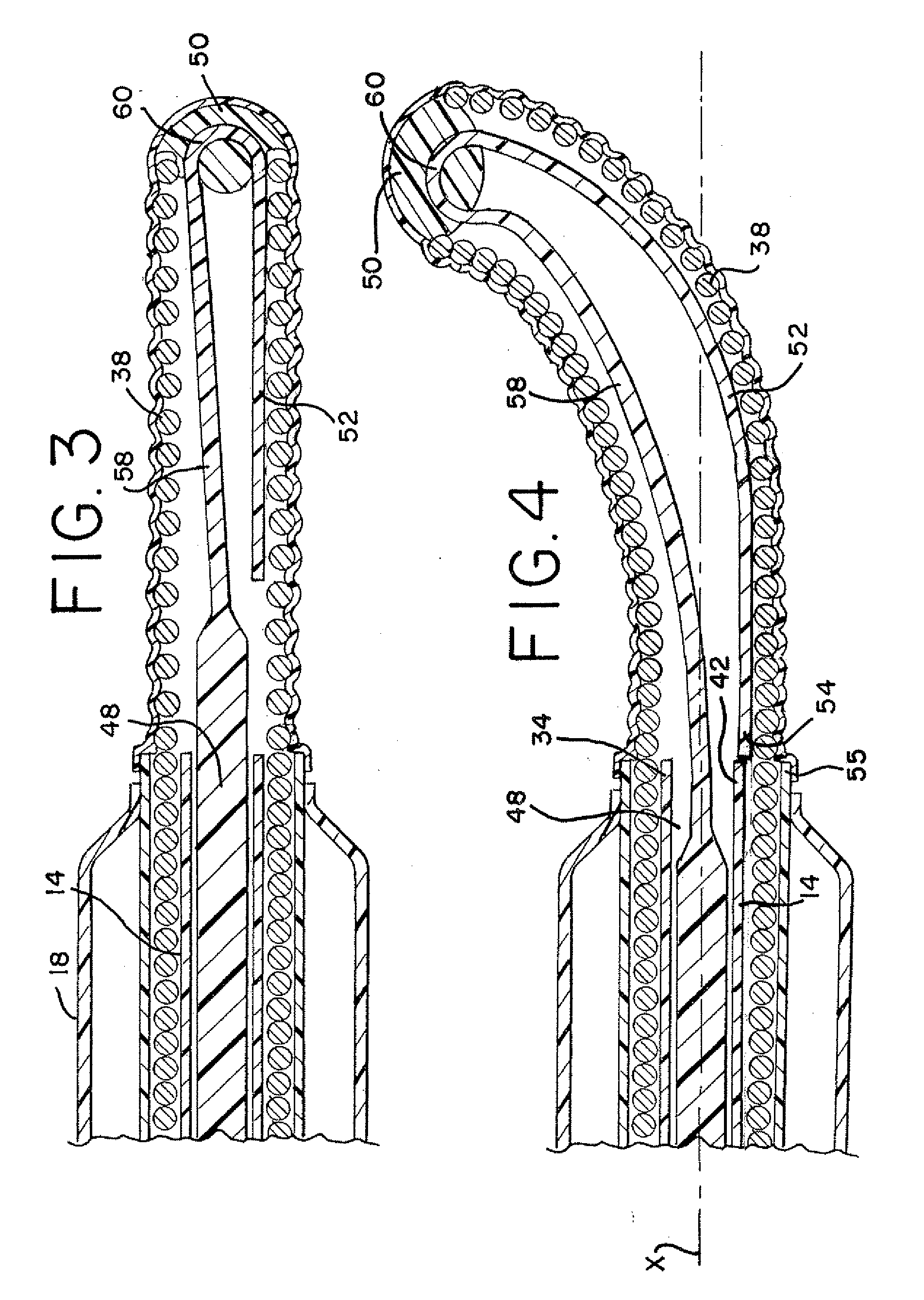 Fixed wire dilatation catheter with an elongateable distal end