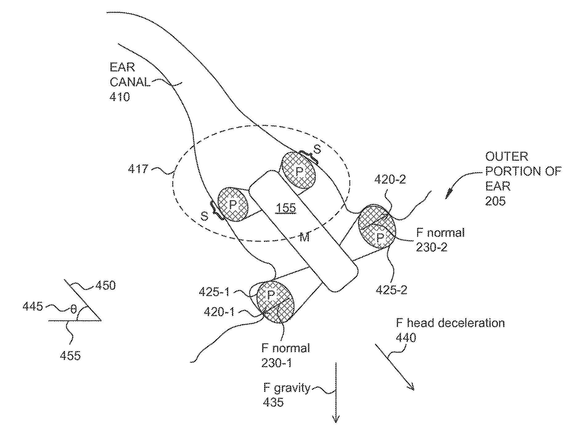 Eartip that conforms to a user's ear canal