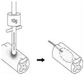 Application of compound to repair of nerve damage