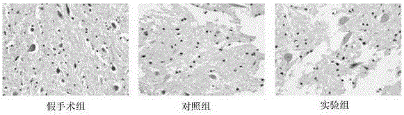 Application of compound to repair of nerve damage