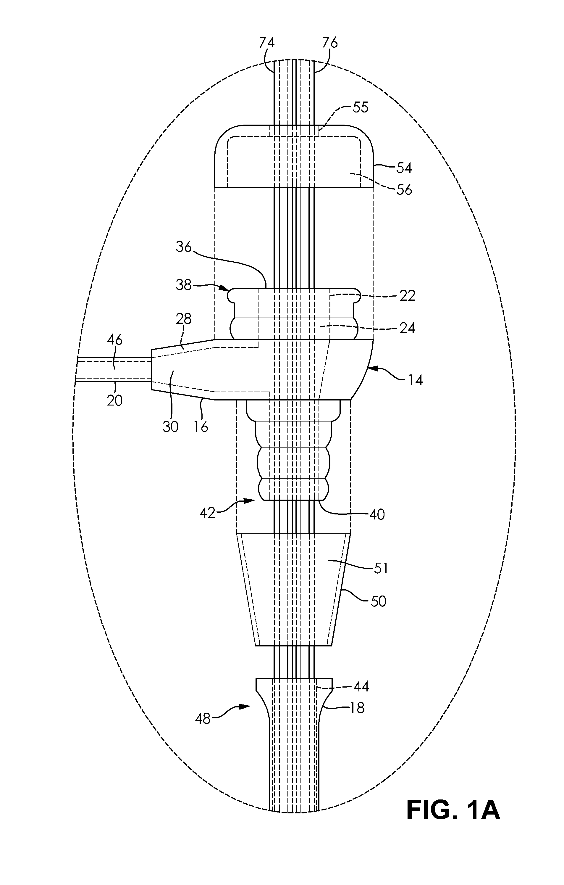 Suction Lithotripsy Apparatus, Method and Kit