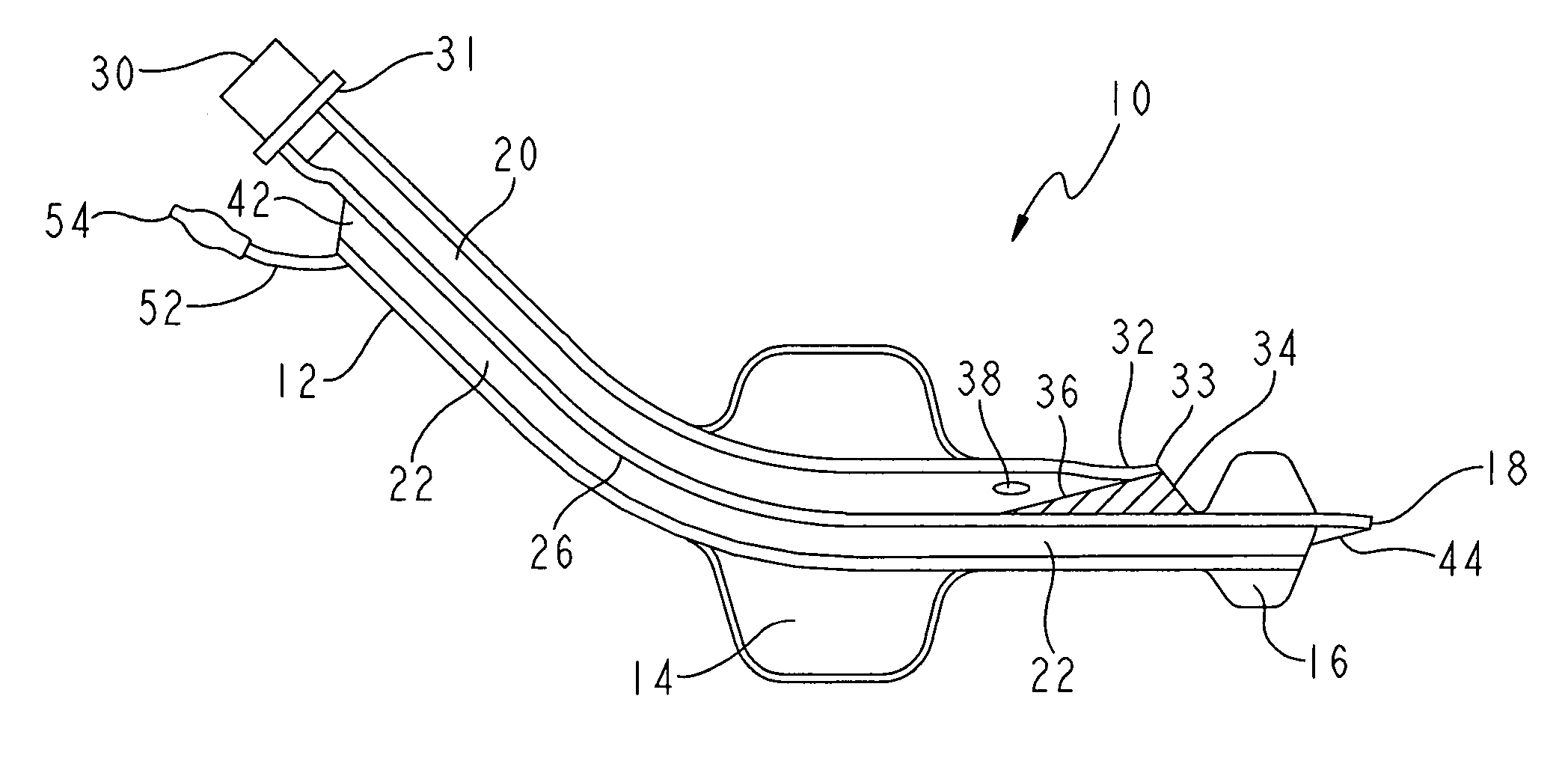 Non-tracheal ventilation tube