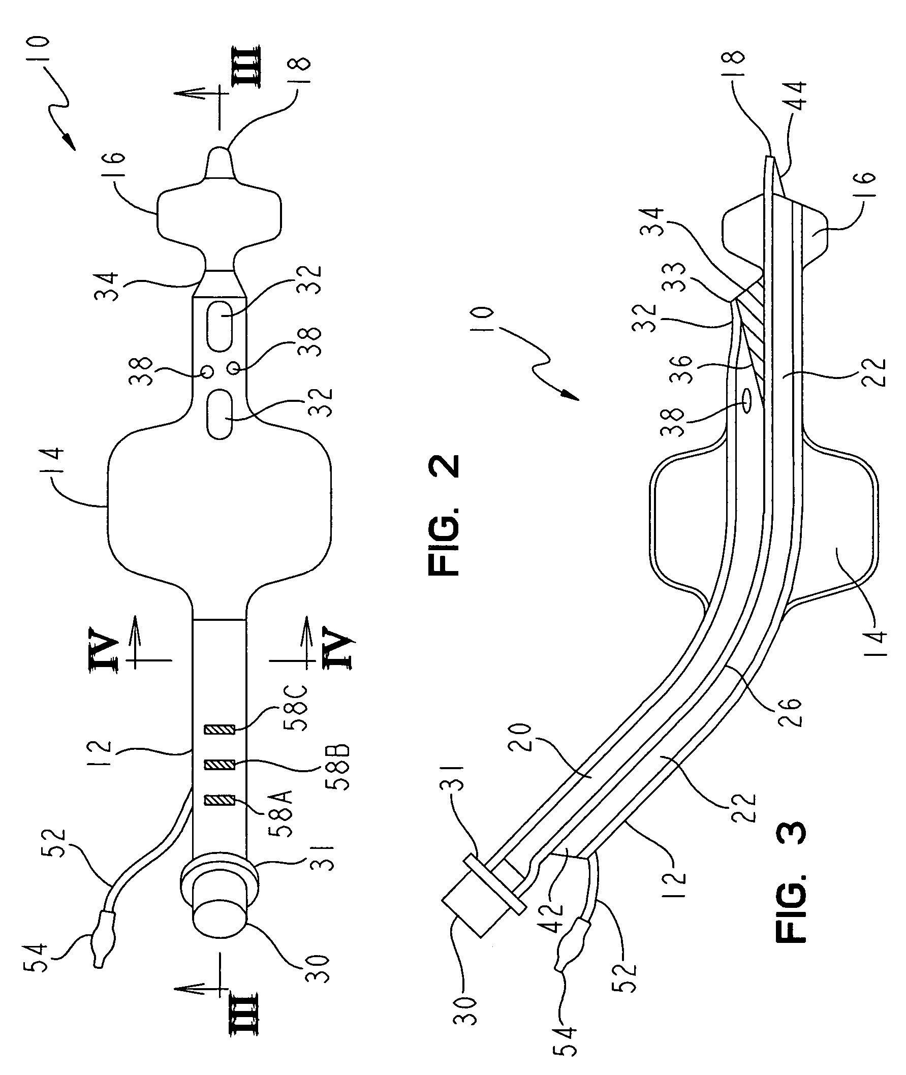 Non-tracheal ventilation tube