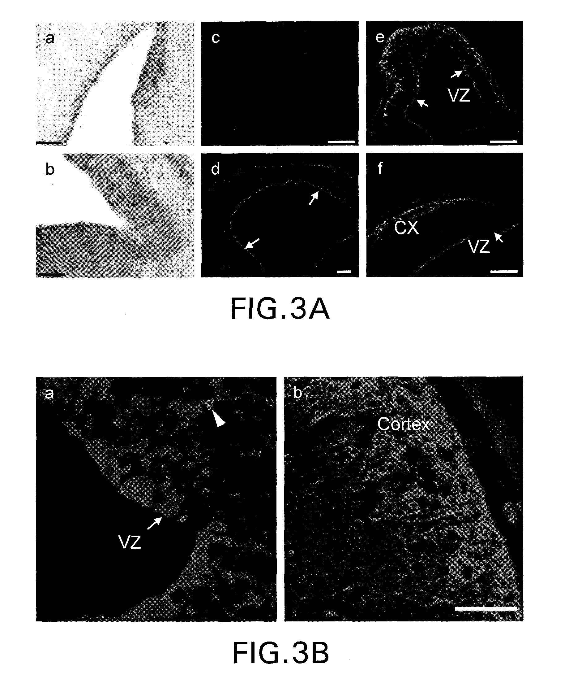 Methods for promoting apoptosis and treating tumor cells inhibiting the expression or function of the transcription factor ATF5