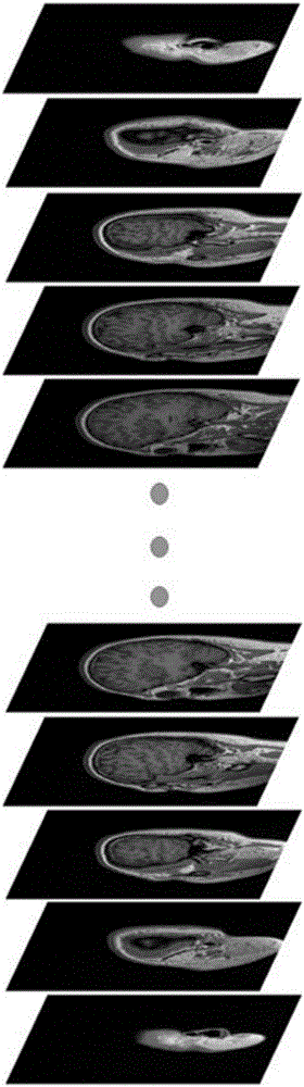 Method for processing head structure image data based on deep learning algorithm