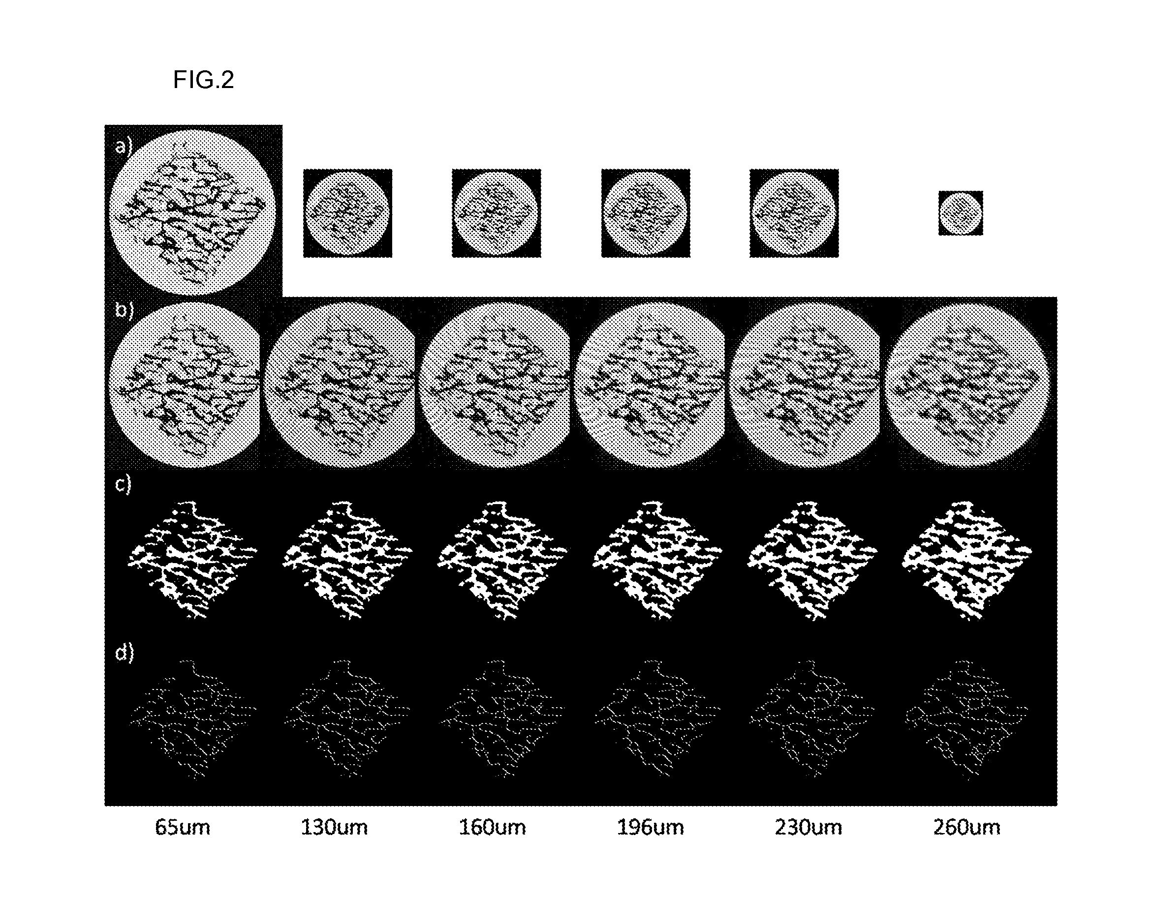 Method For Measuring Trabecular Bone Parameters From MRI Images