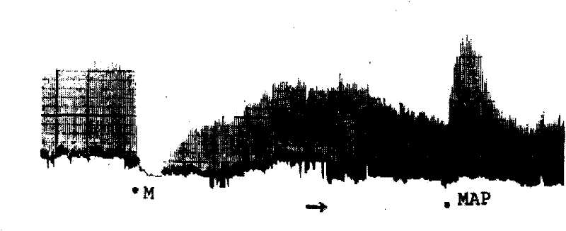 Anti-opioid peptide antagonist peptide and use thereof