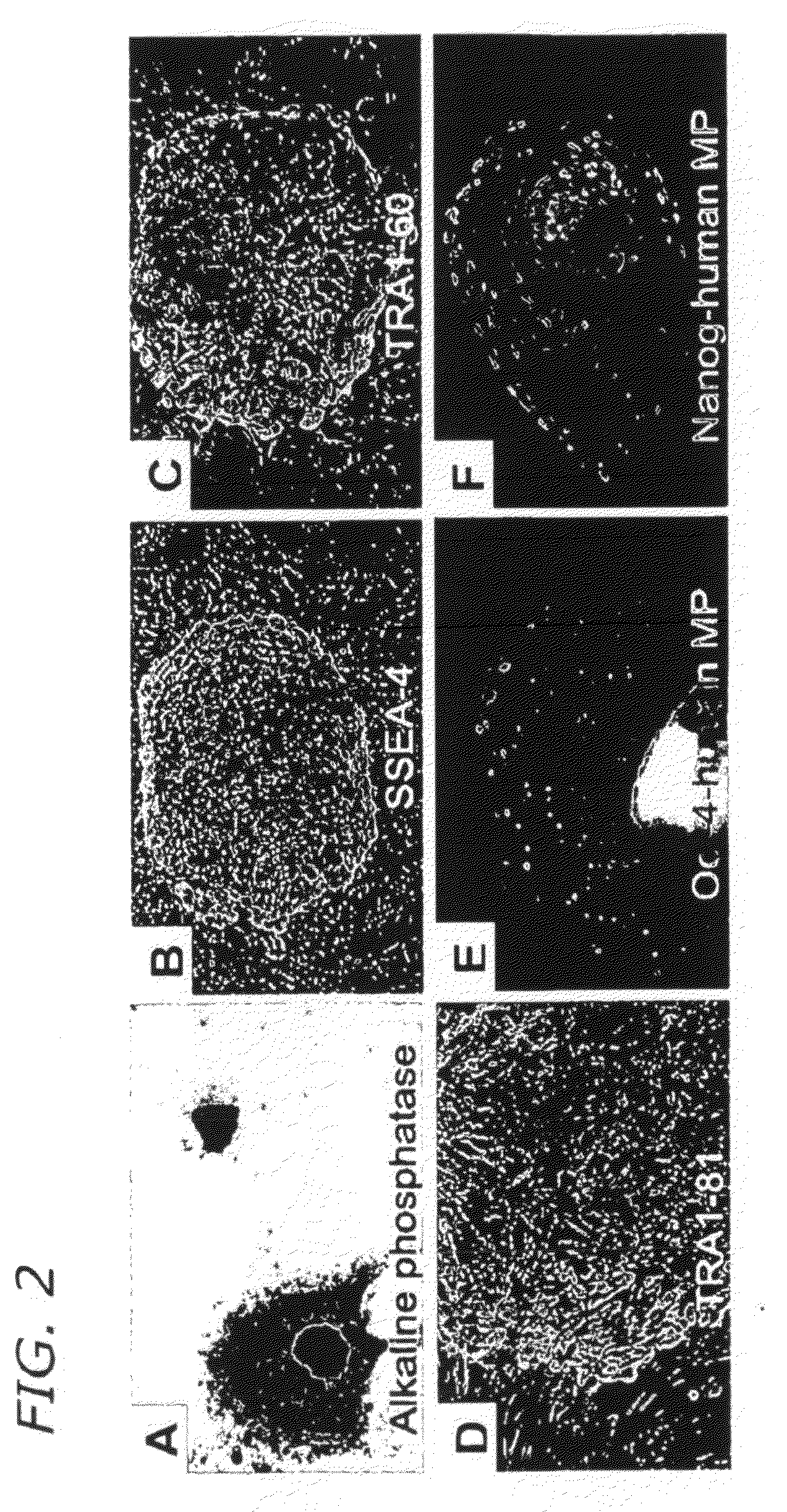 Isolation, Characterization and Propagation of Germline Stem Cells