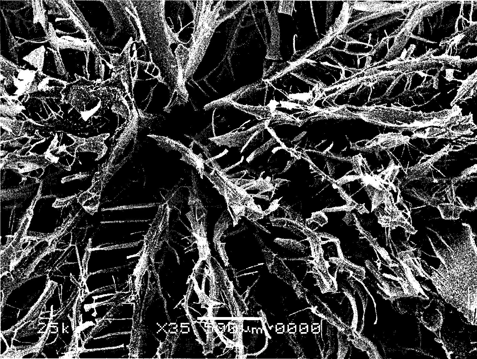 Method for preparing composite bone repair stent material containing chitosan and hydroxylapatite