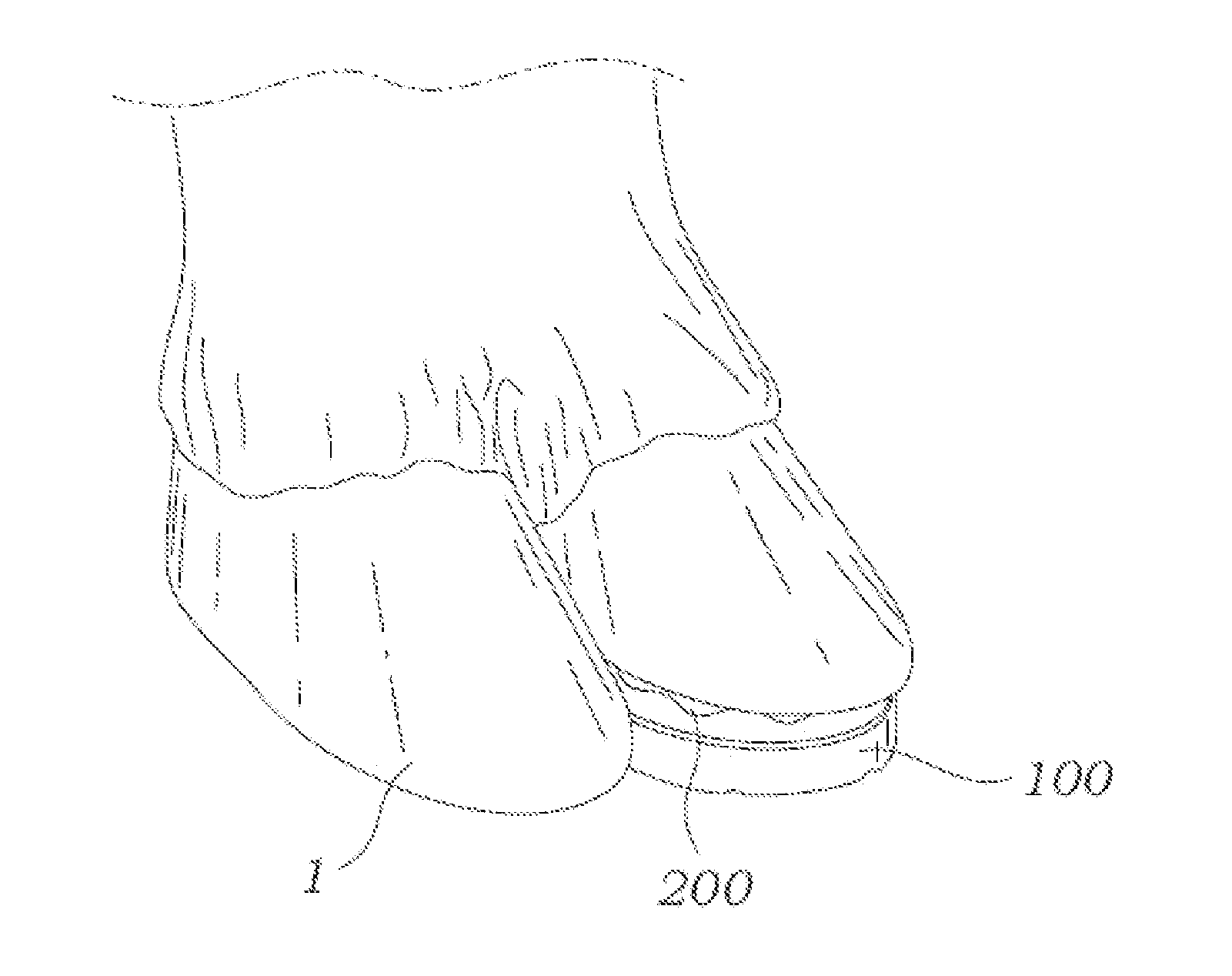 Methods and compositions for treating a hoof of an ungulate animal