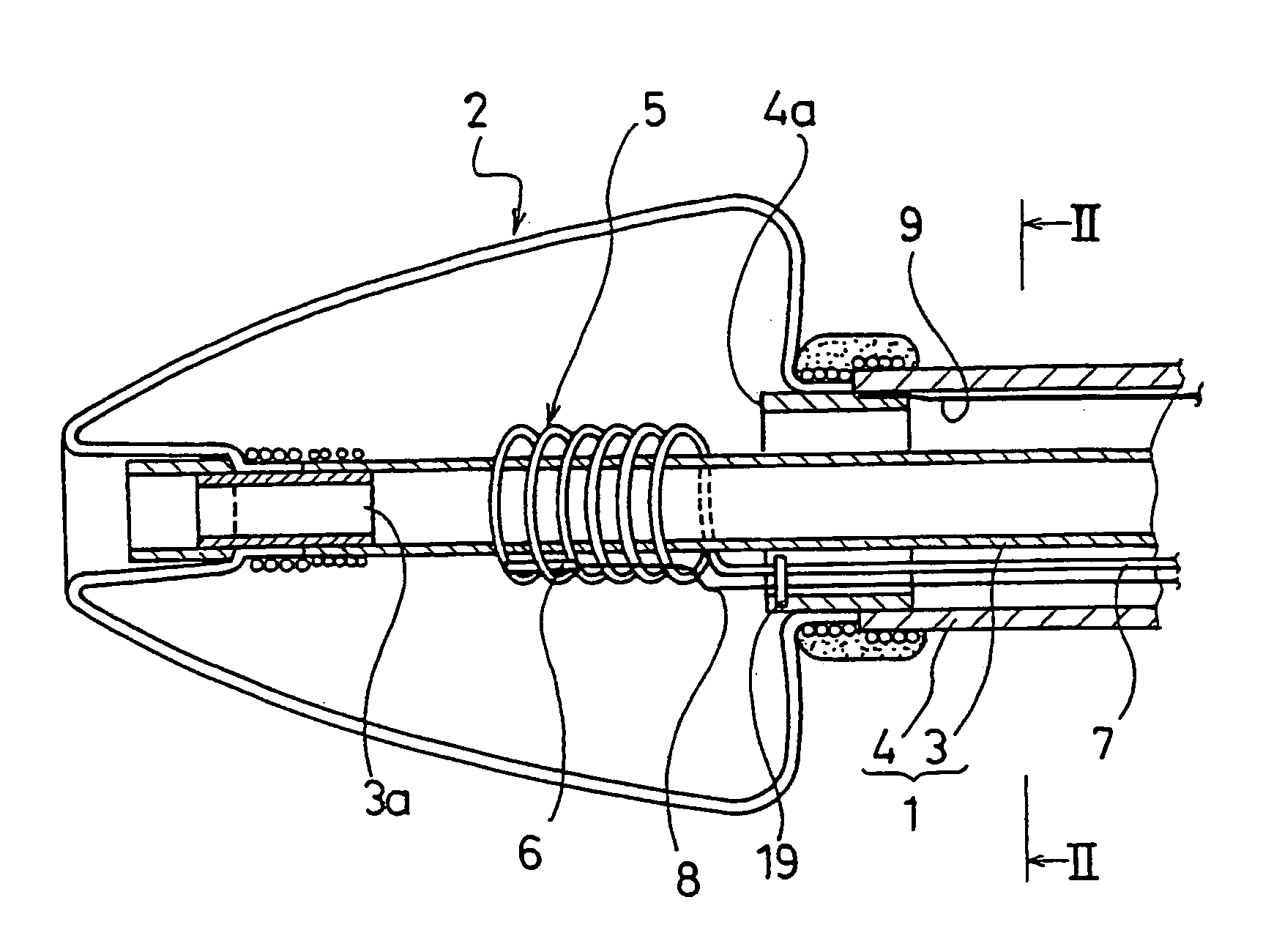 Catheter for treating irregular heart pulse