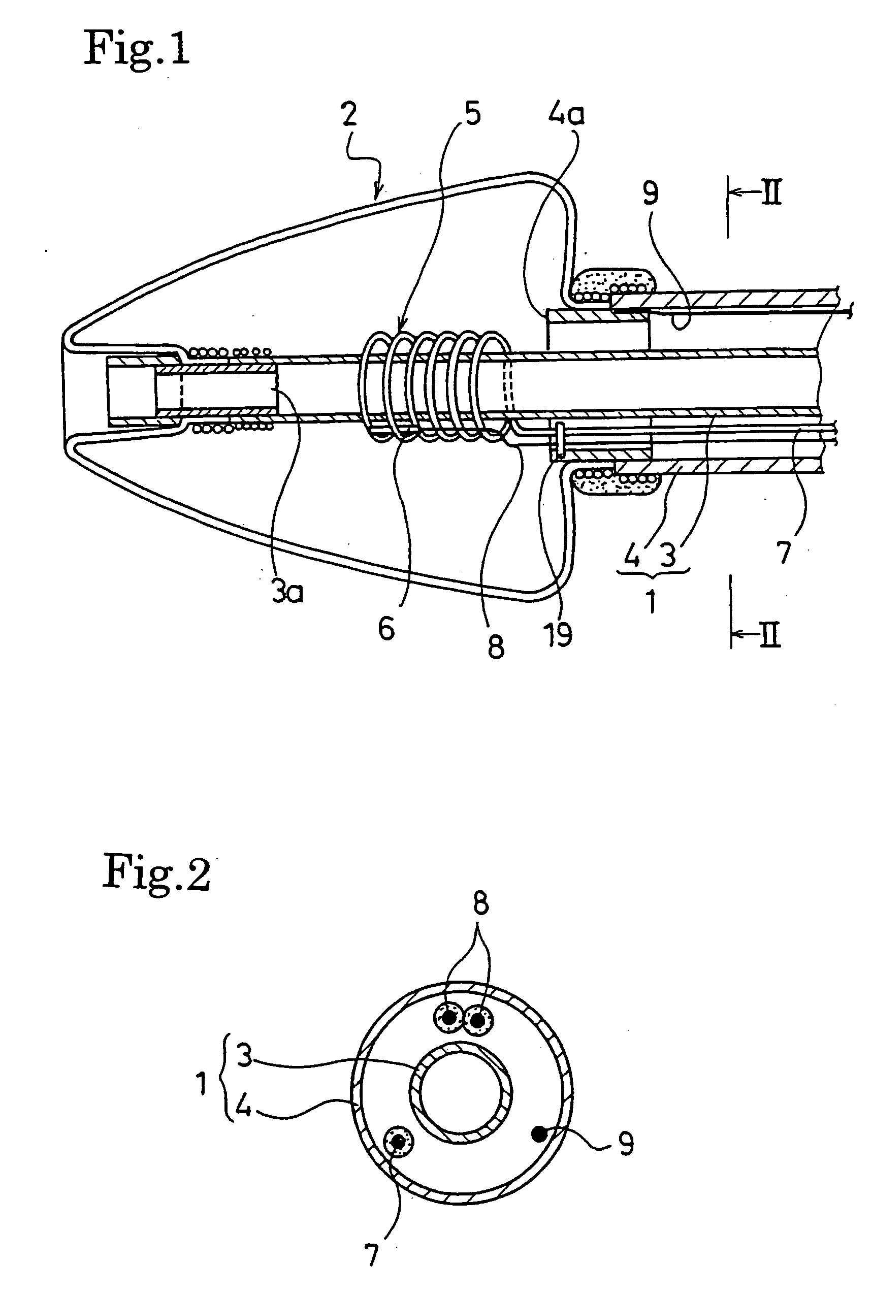 Catheter for treating irregular heart pulse