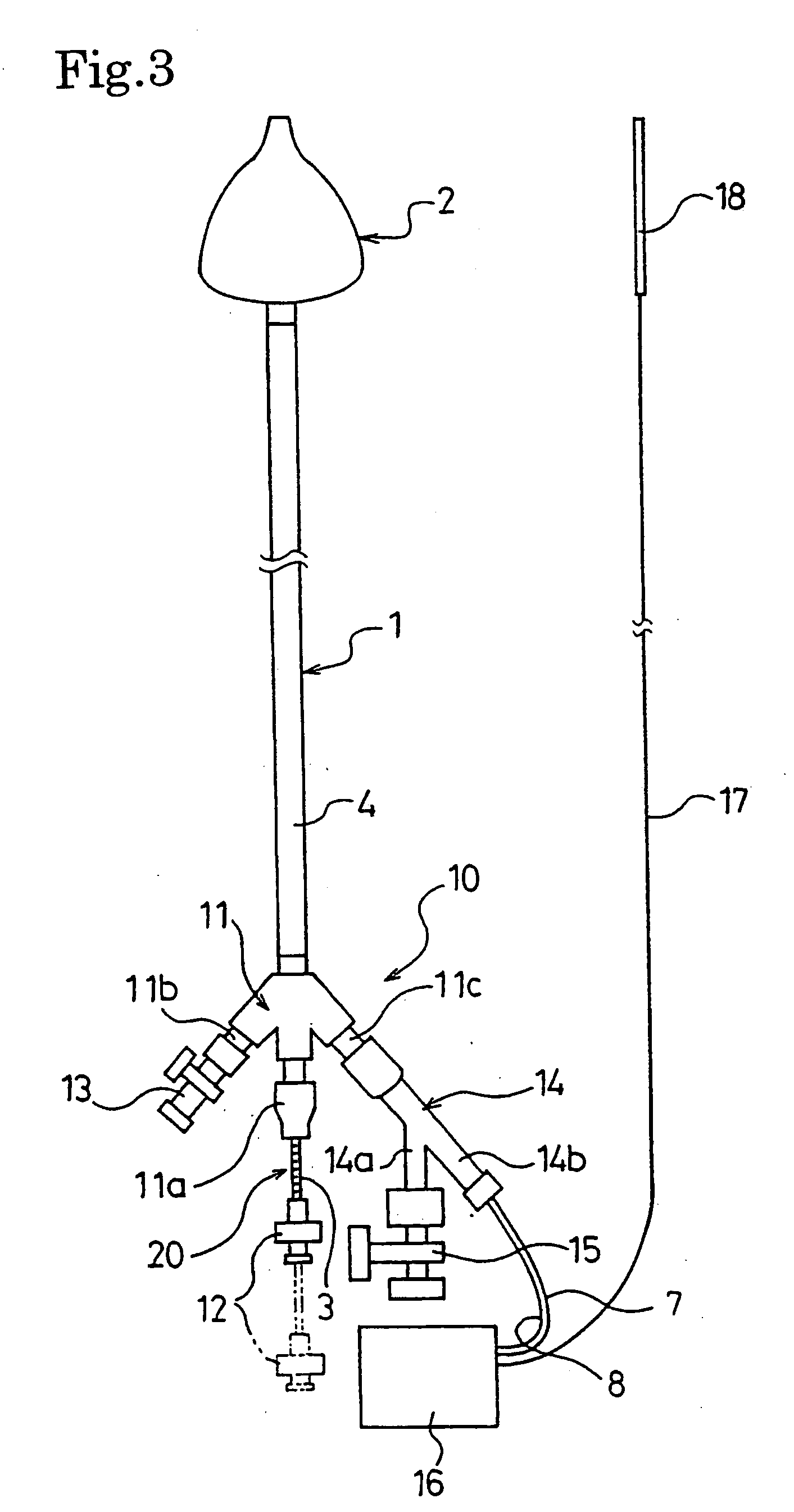 Catheter for treating irregular heart pulse