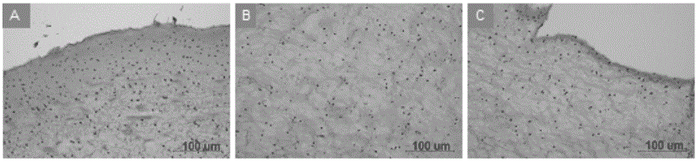 Jellyfish paraffin section making method