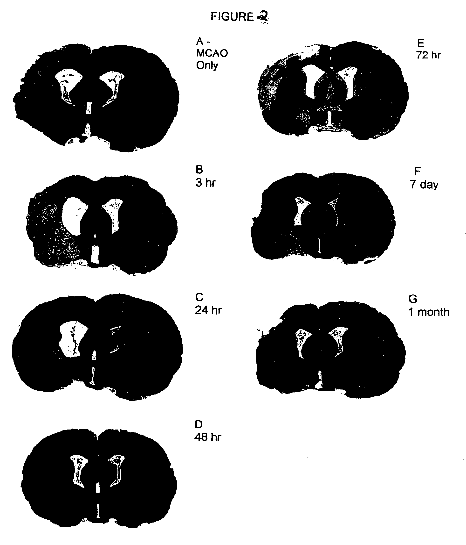 Method of potentiating inflammatory and immune modulation for cell and drug therapy