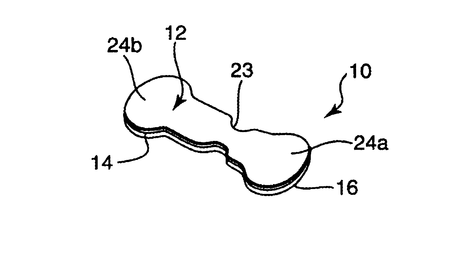 Conformable adhesive wound closures