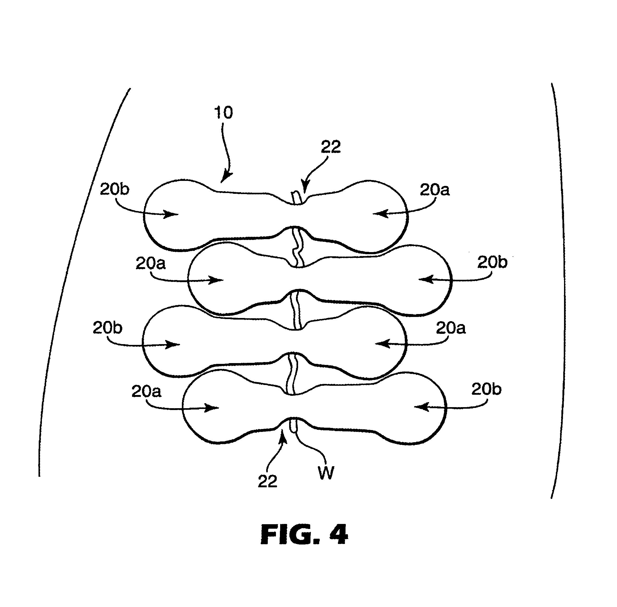 Conformable adhesive wound closures