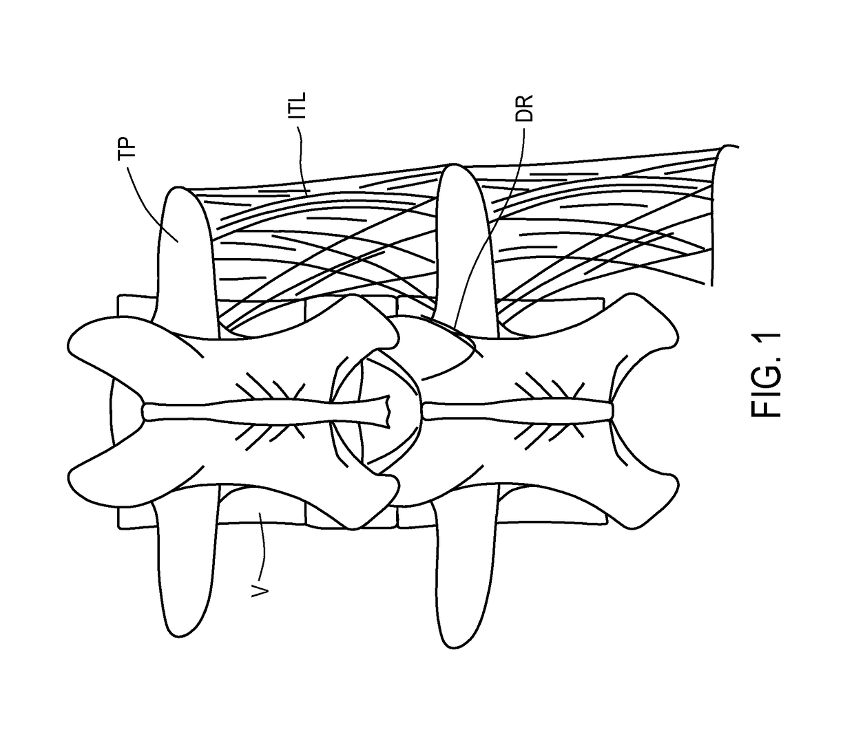 Apparatus and methods for anchoring electrode leads adjacent to nervous tissue