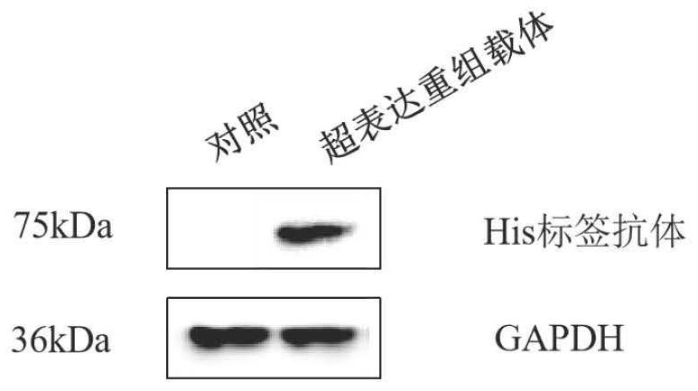 Fusion expression protein as well as preparation method and application thereof