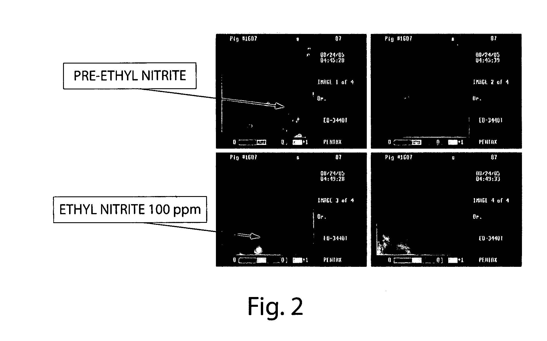 Ethyl nitrite as a gastrointestinal smooth muscle relaxant and diagnostic and therapeutic uses thereof