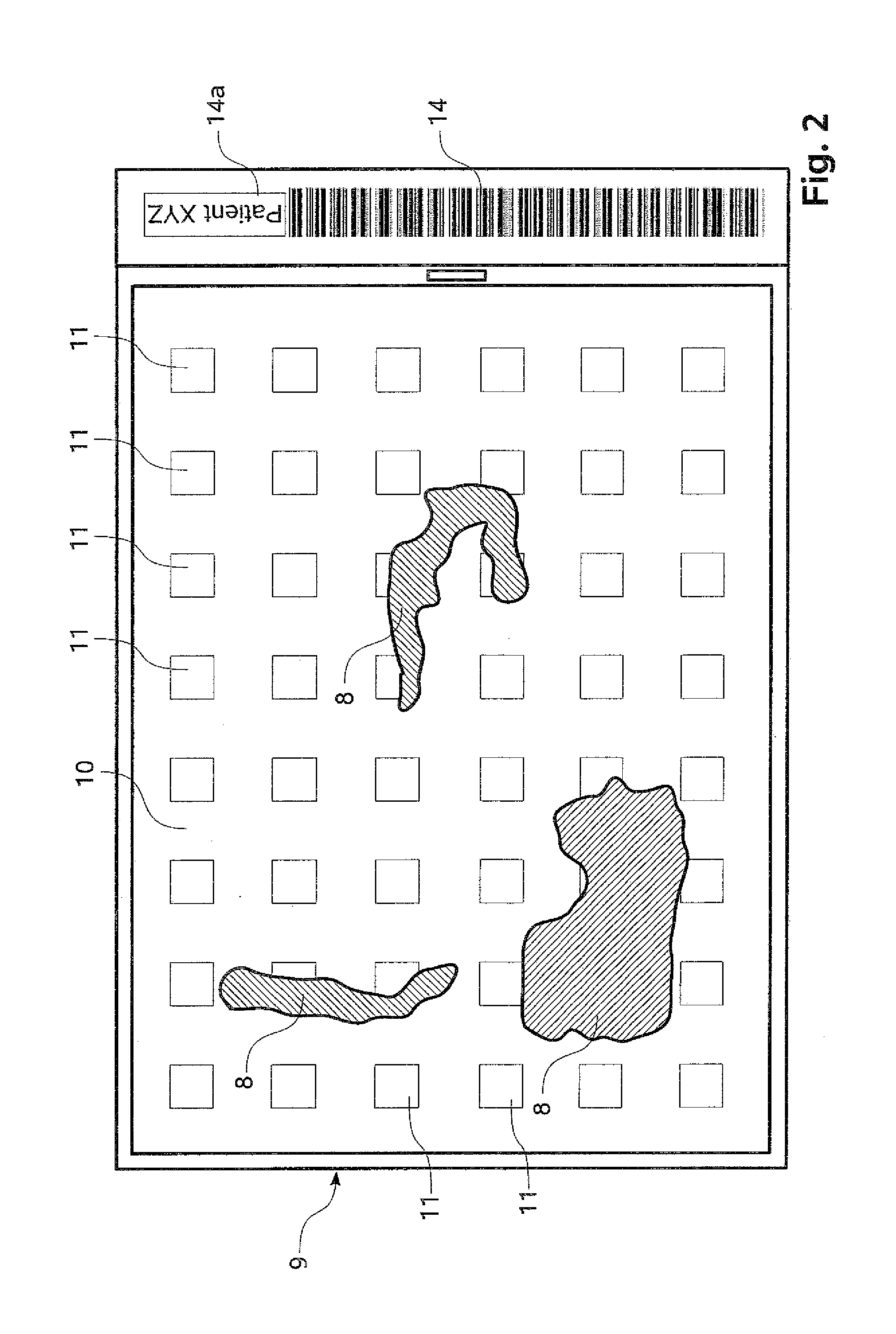 Tissue embedding apparatus, and method for operating a tissue embedding apparatus