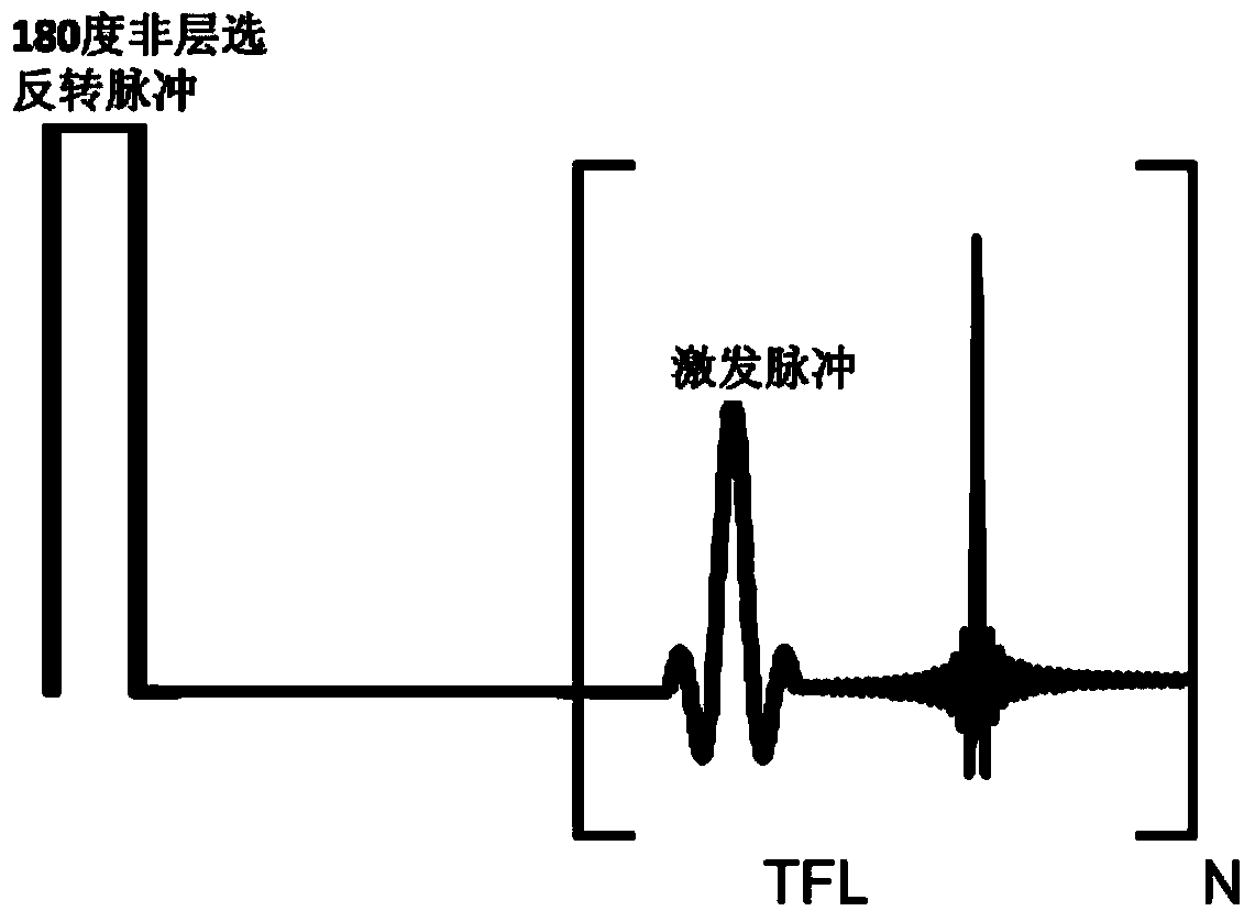 Myocardium T1 value measuring method and system